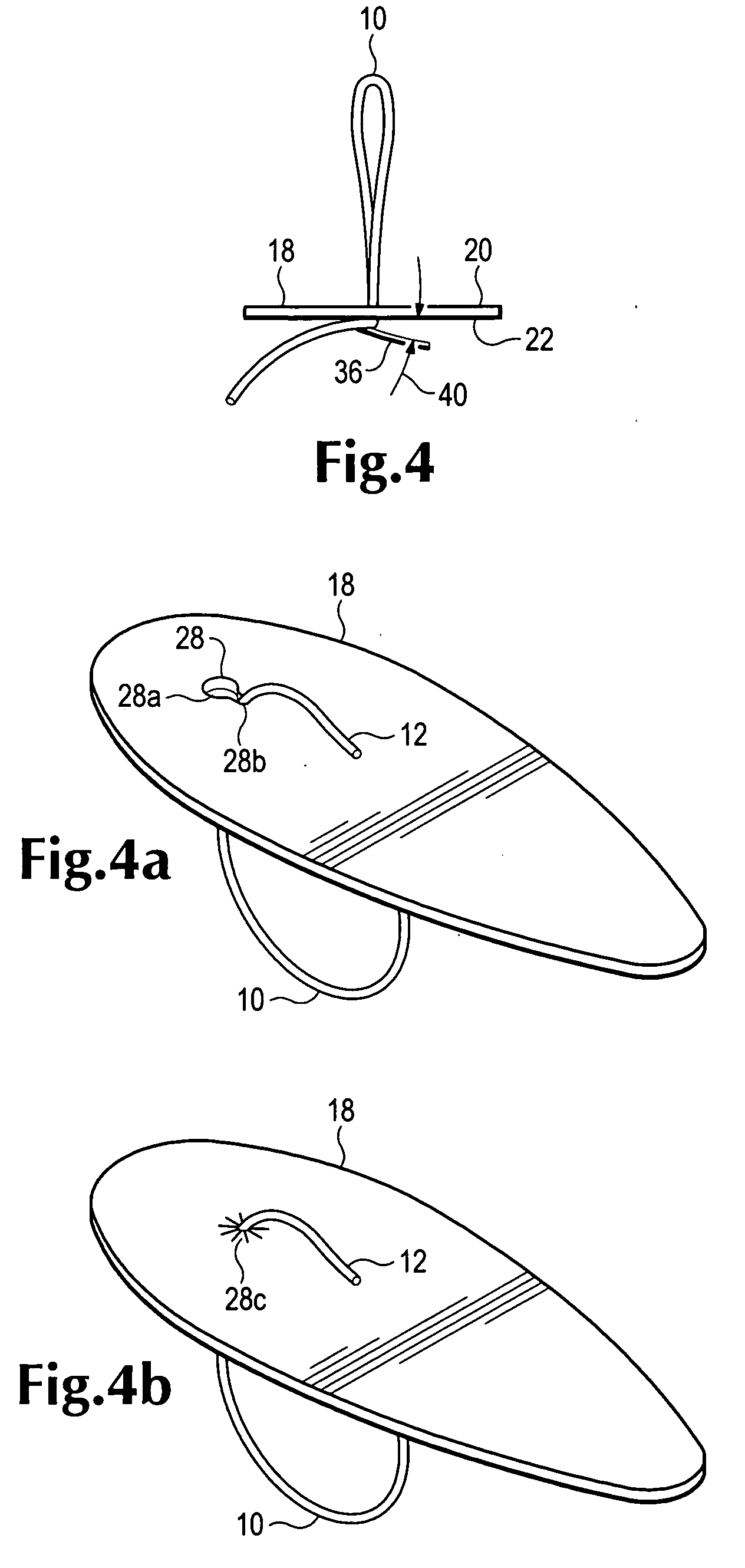 Device for repositioning cartilage and method of use