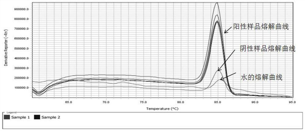 Primer for fluorescent quantitative detection of strawberry mottle virus and application of primer