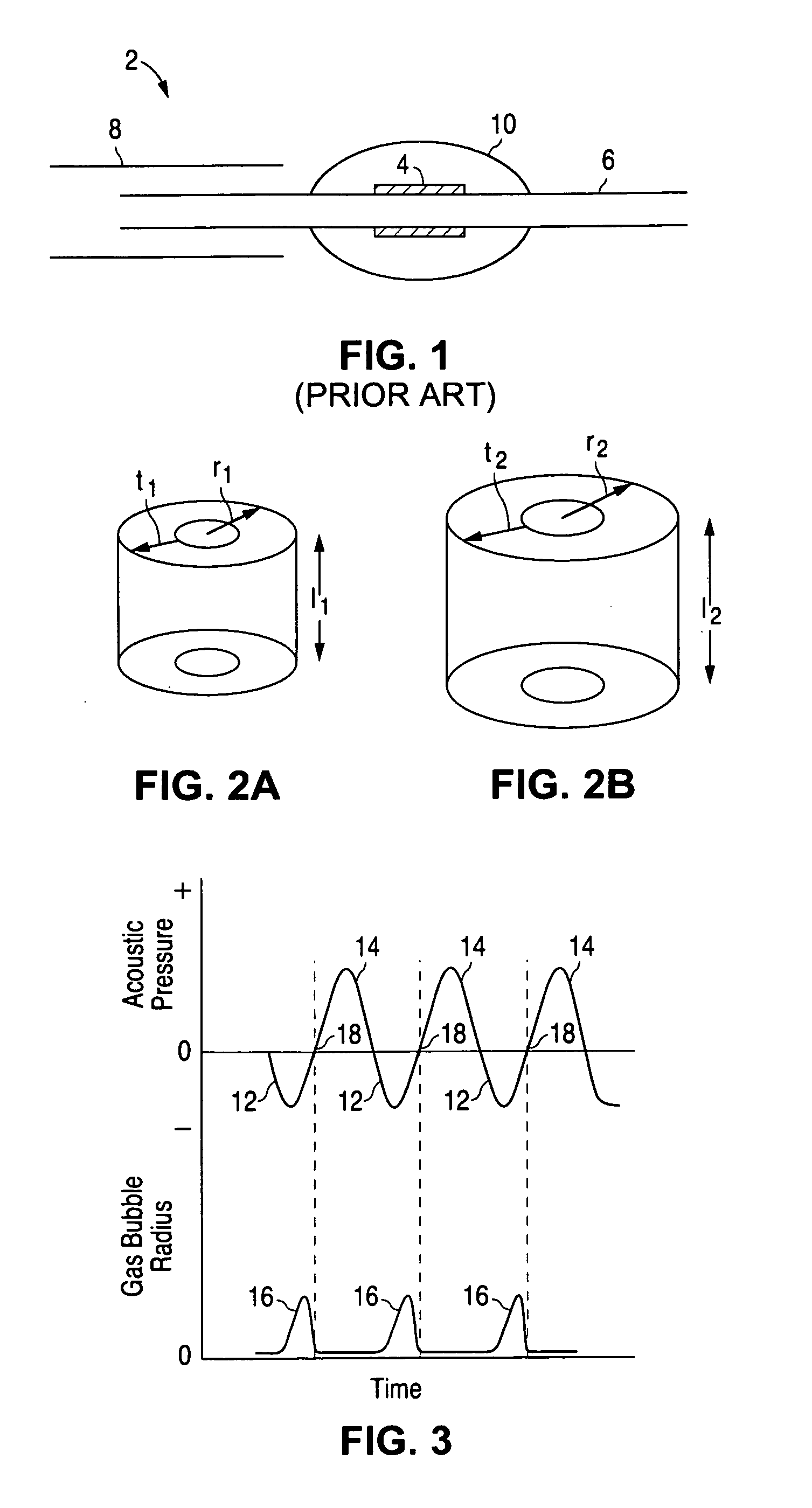Medical assembly with transducer for local delivery of a therapeutic substance and method of using same