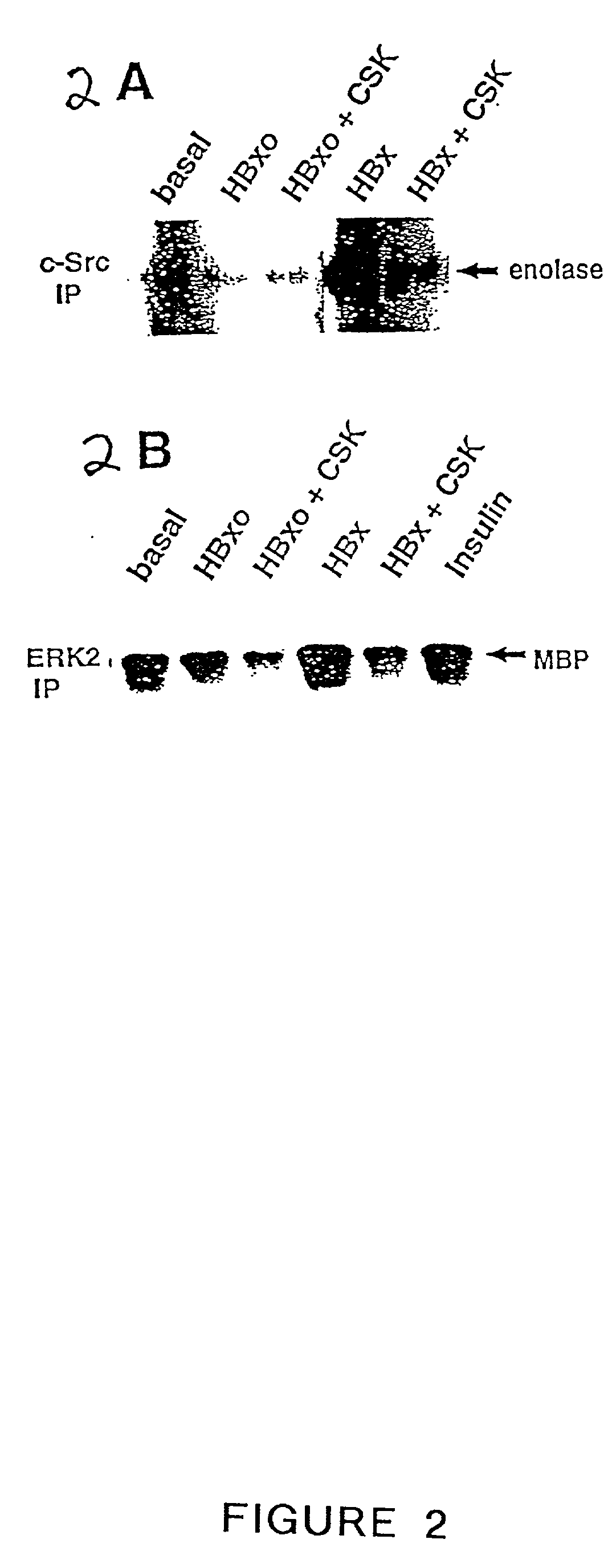 Inhibition of the SRC kinase family pathway as a method of treating HBV infection and hepatocellular carcinoma