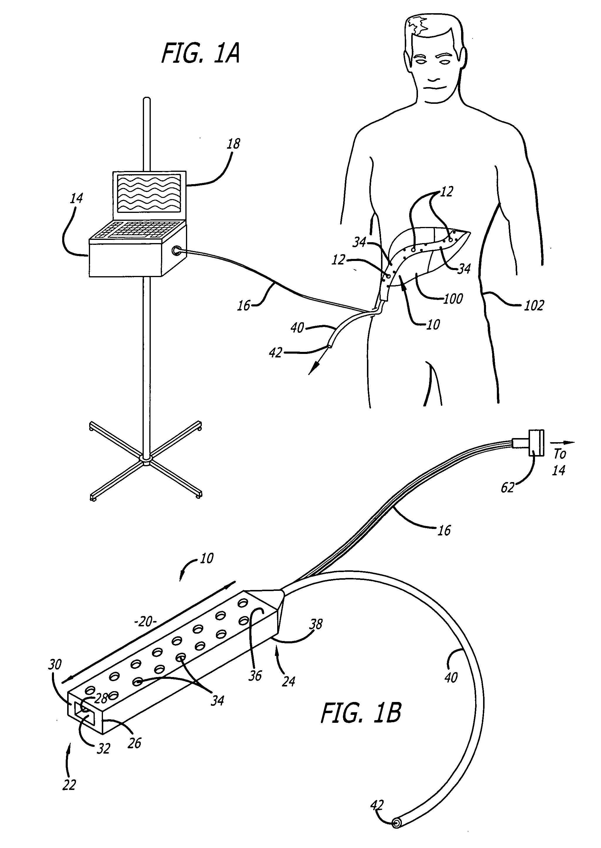 Surgical drain with sensors for monitoring fluid lumen