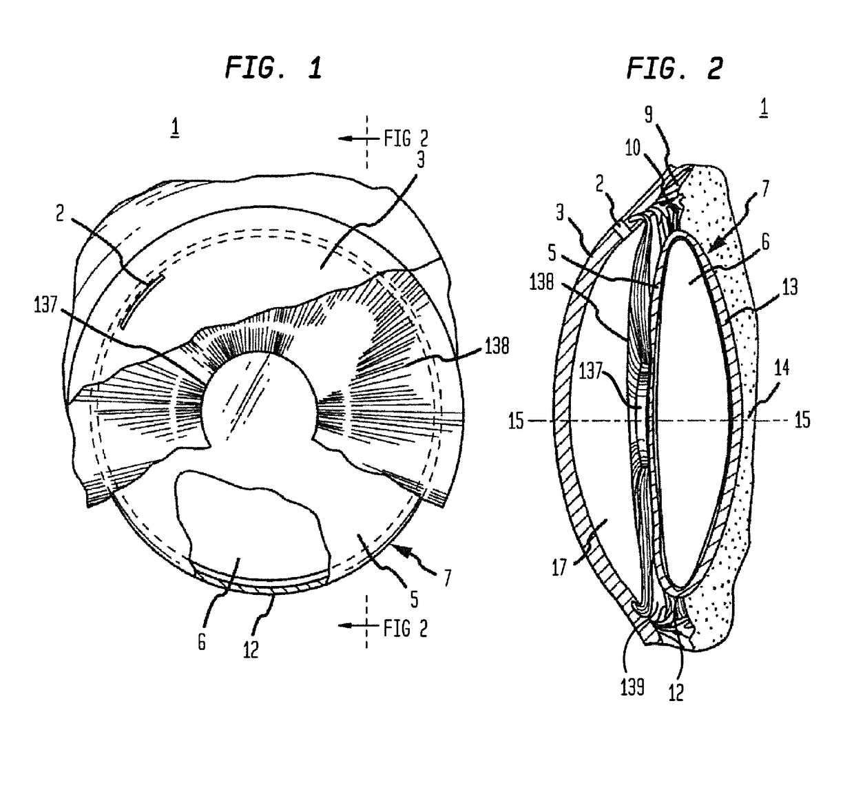 Micropatterned intraocular implant