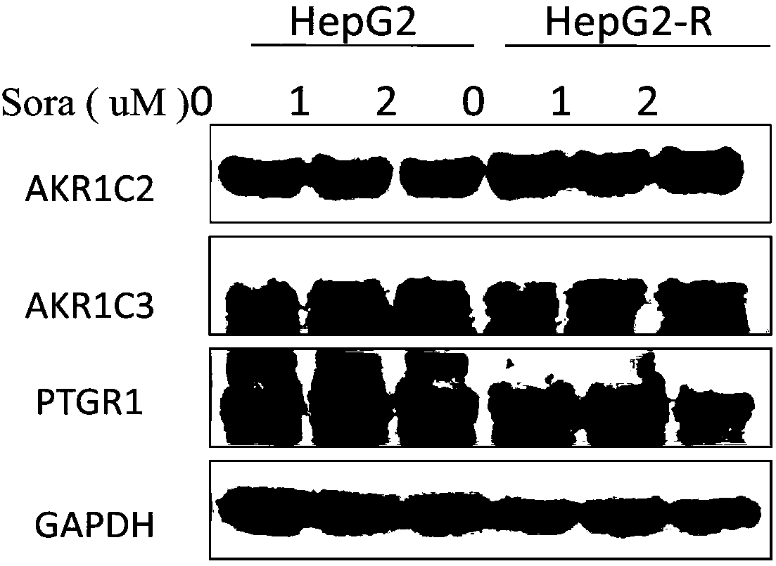 Pharmaceutical composition reversing resistance of hepatoma carcinoma cells to sorafenib