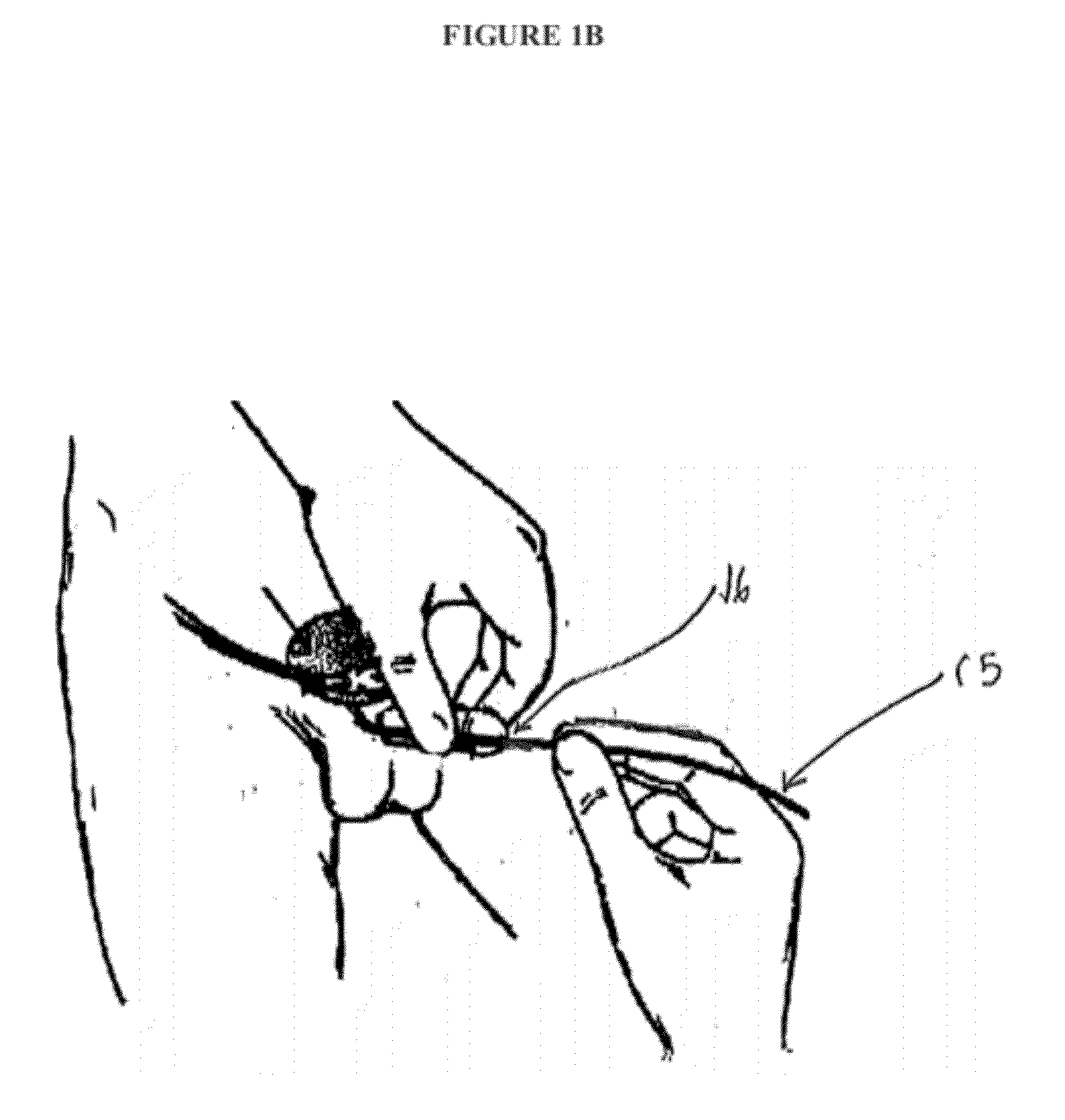 Methods and Devices for Preventing Catheter Related Urinary Tract Infections