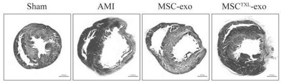 Mesenchymal stem cell-derived exosomes based on Tongxinluo pretreatment and preparation method thereof