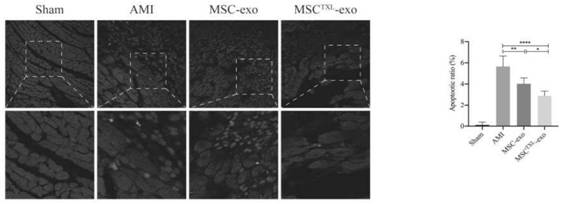 Mesenchymal stem cell-derived exosomes based on Tongxinluo pretreatment and preparation method thereof