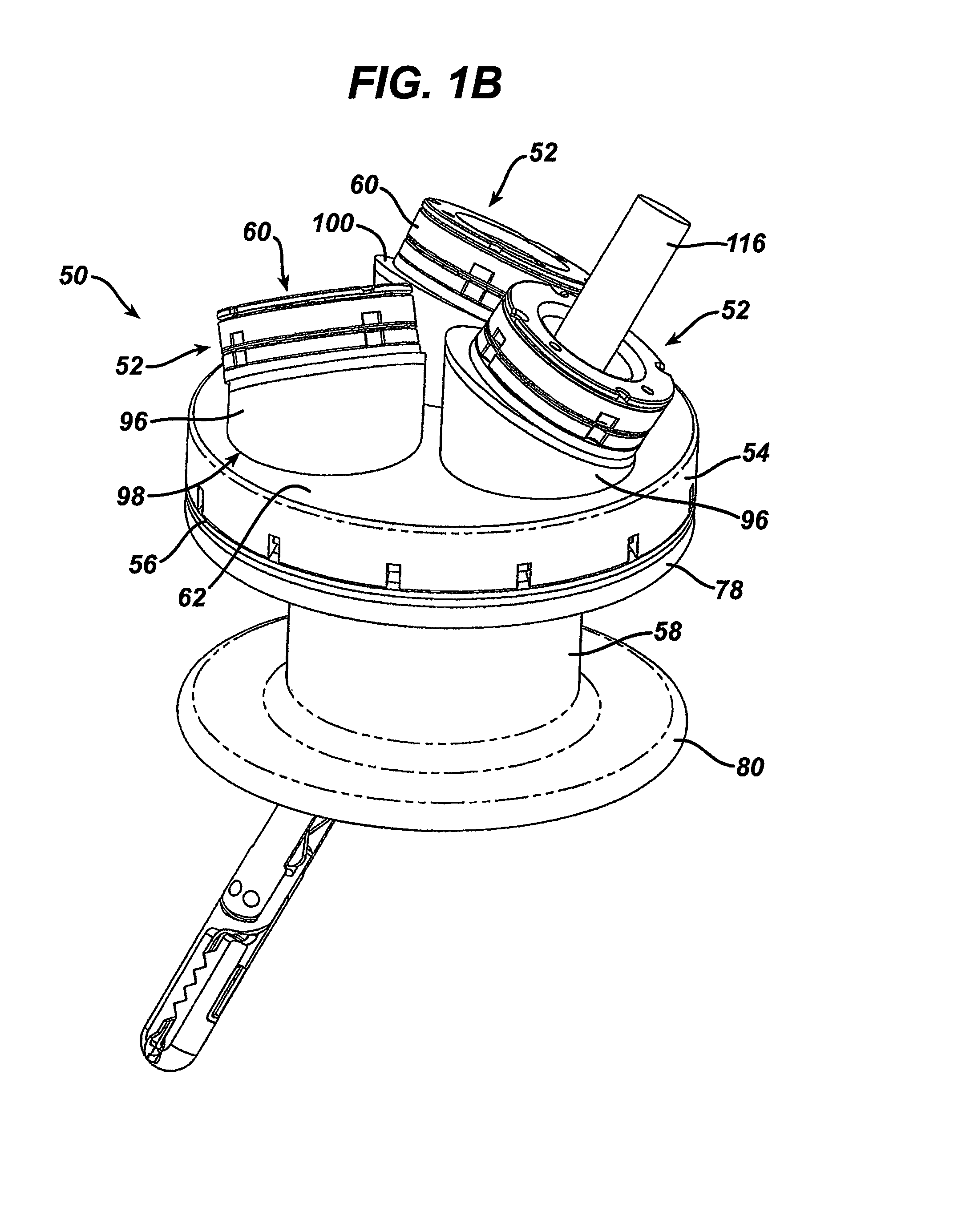 Variable surgical access device