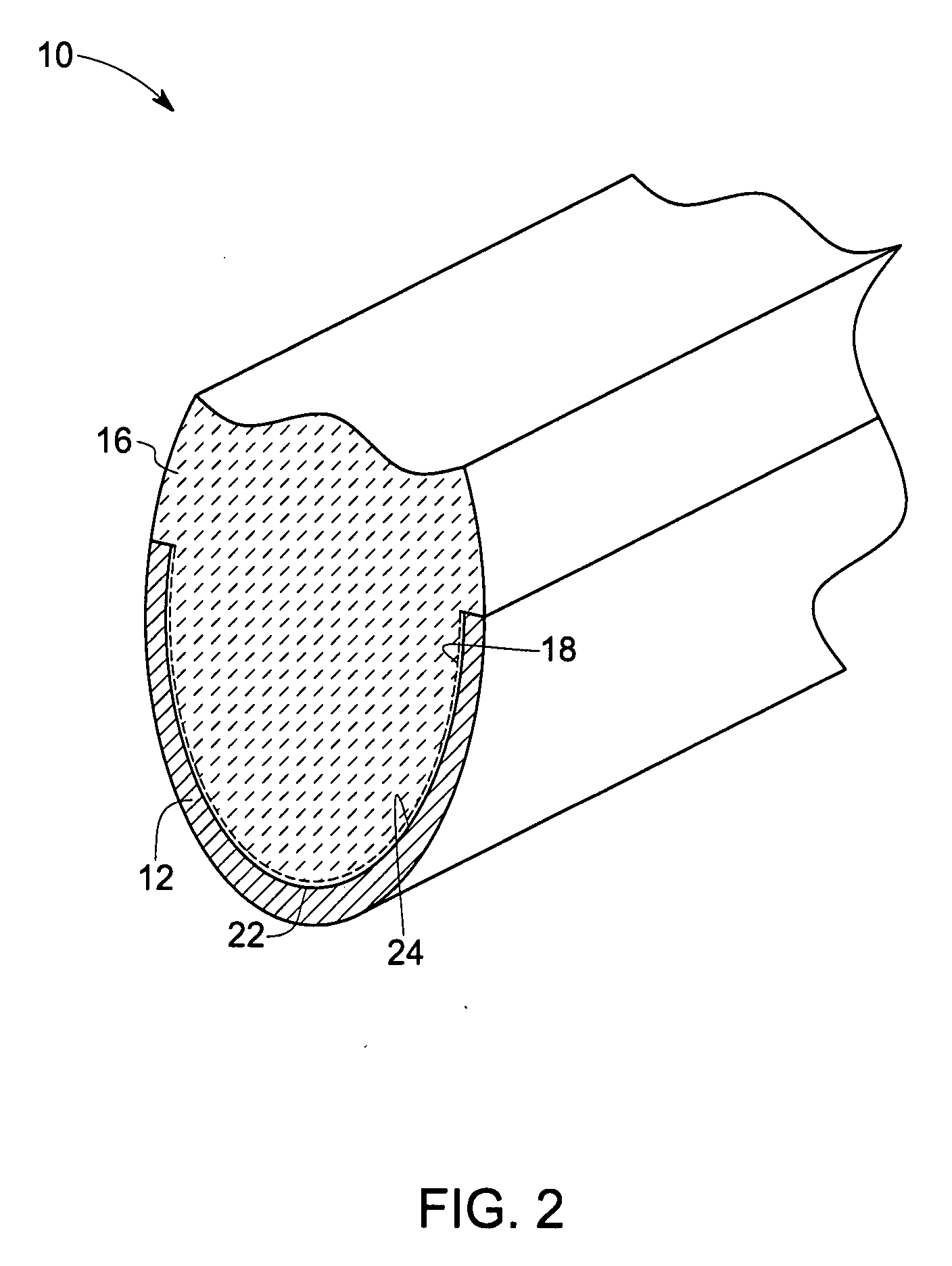 Method for roughening metal surfaces and article manufactured thereby