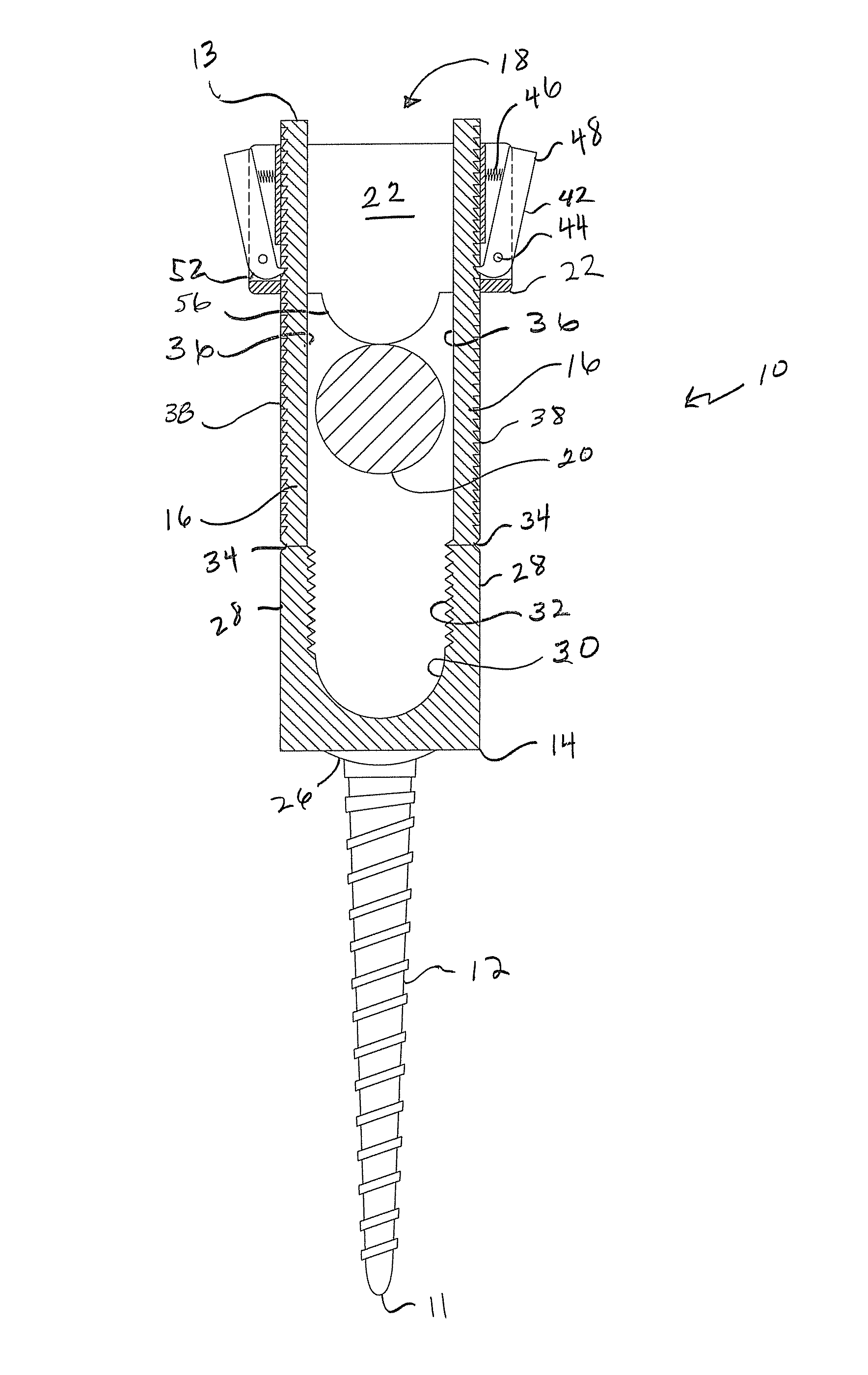 Screw and rod fixation system