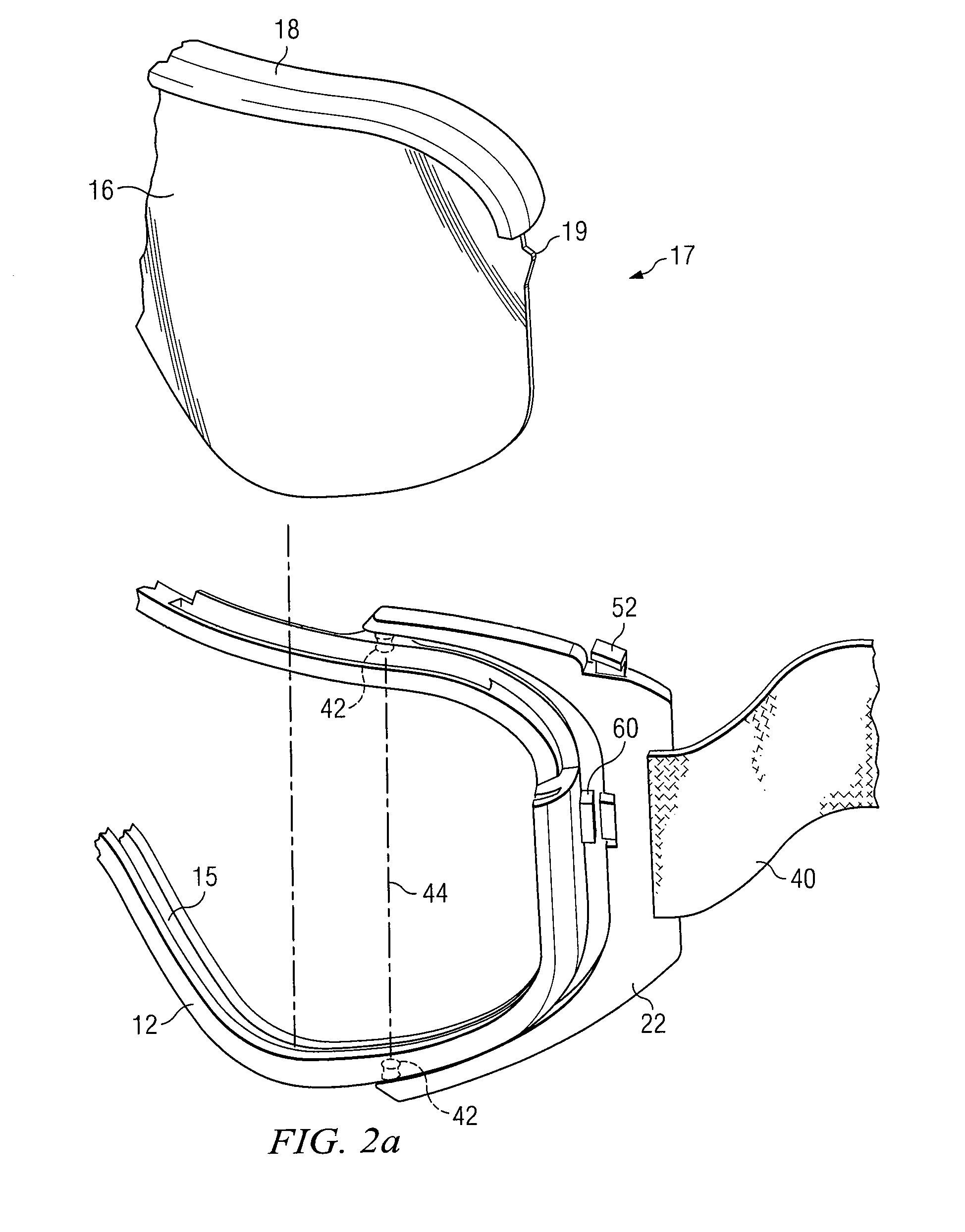 Lens replacement system