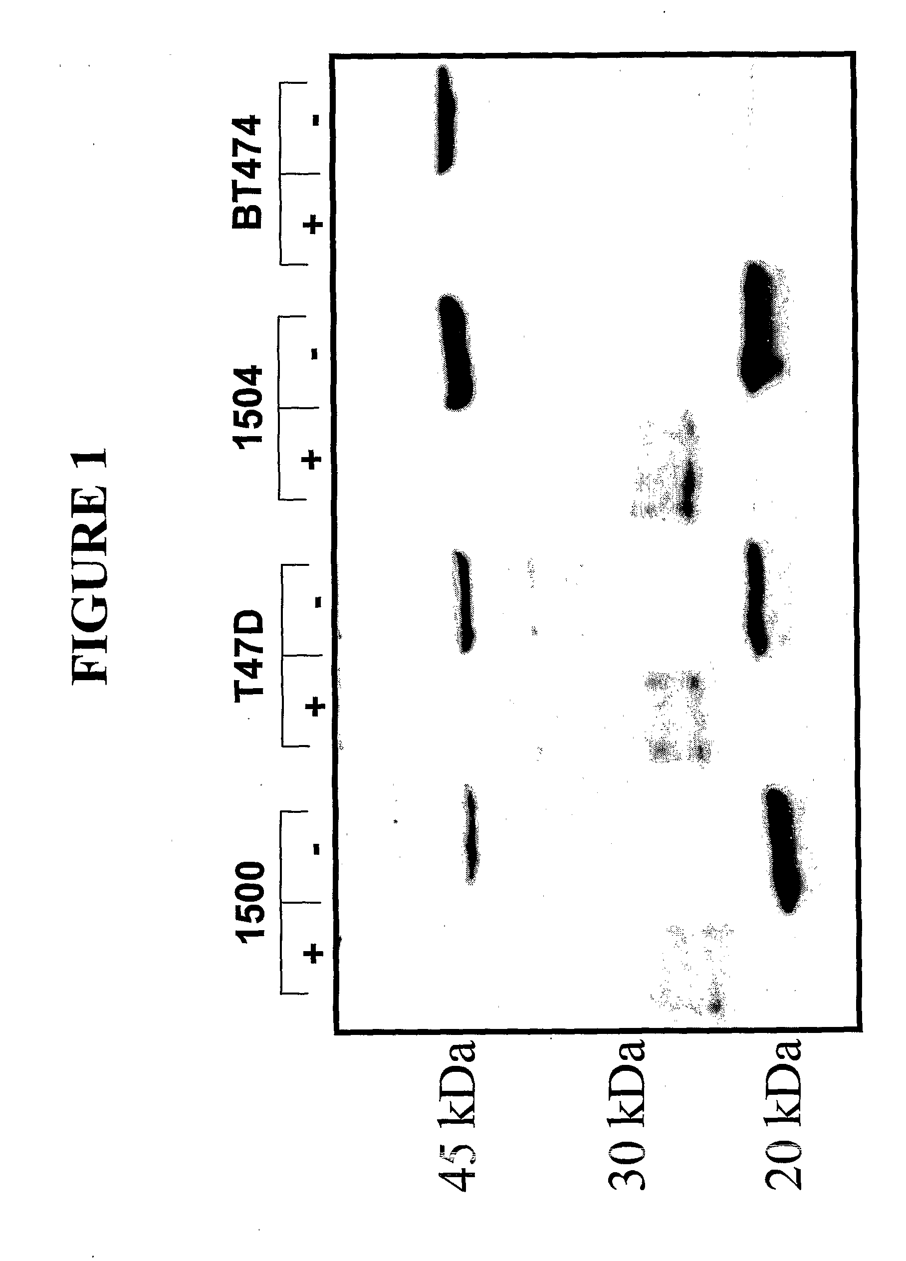 Methods for Diagnosis and Treatment of Cancer