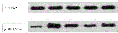 Traditional Chinese medicine composition for treating interstitial lung disease at later period of thoracic neoplasms chemoradiotherapy and preparation method thereof