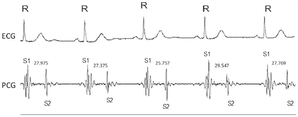 Method and device for assessing heart fatigue degree