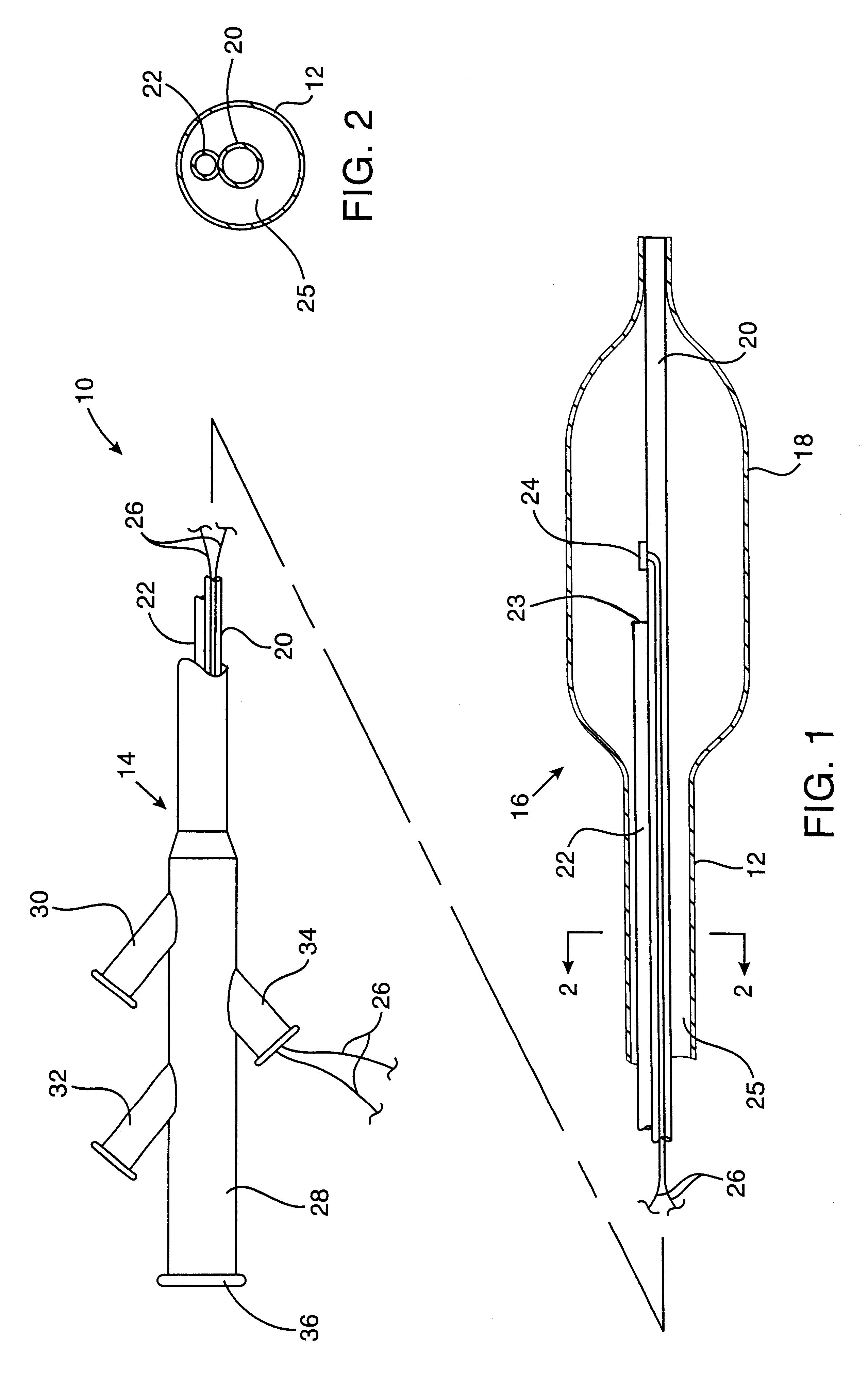 Apparatus and method for cryogenic inhibition of hyperplasia