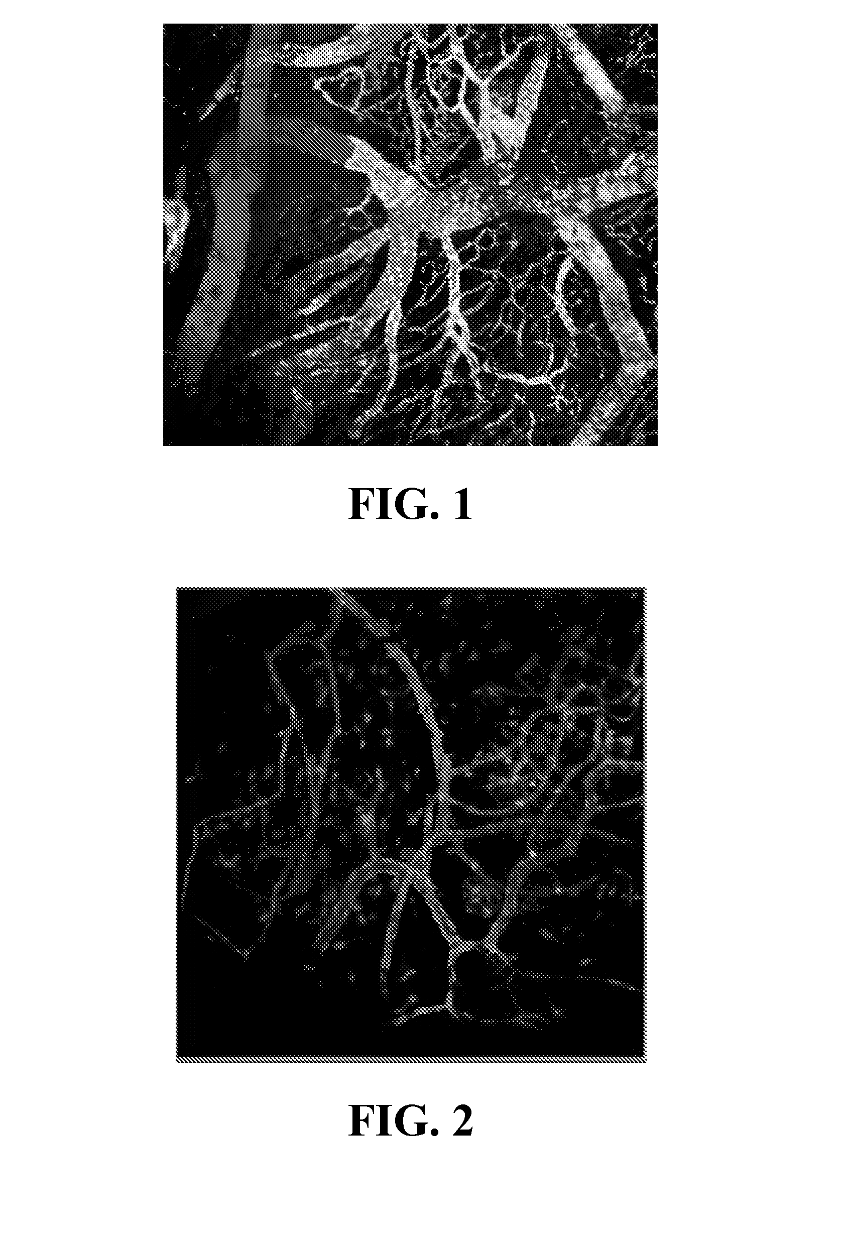 Cell systems and methods for delivering disease-specific therapies