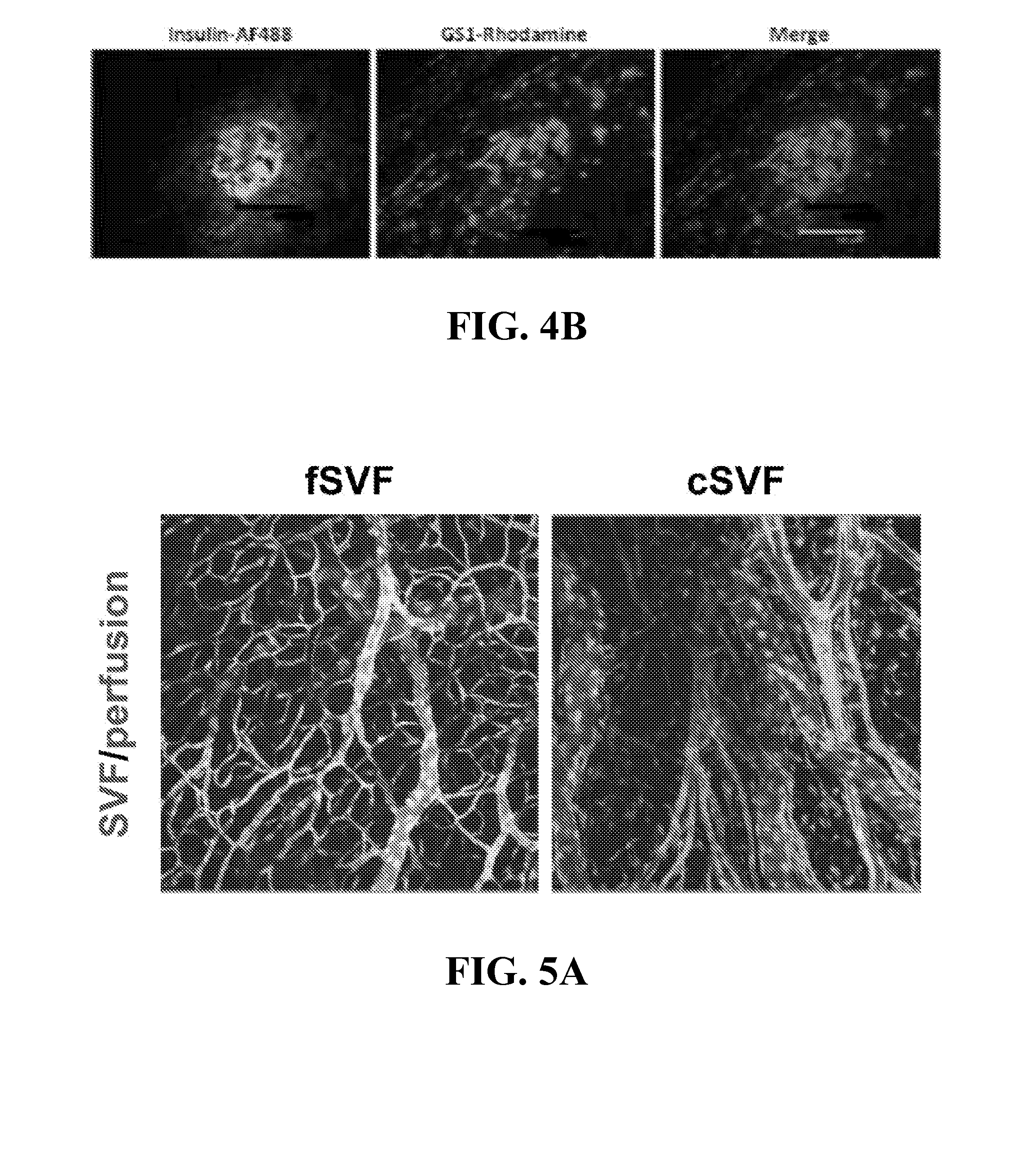 Cell systems and methods for delivering disease-specific therapies
