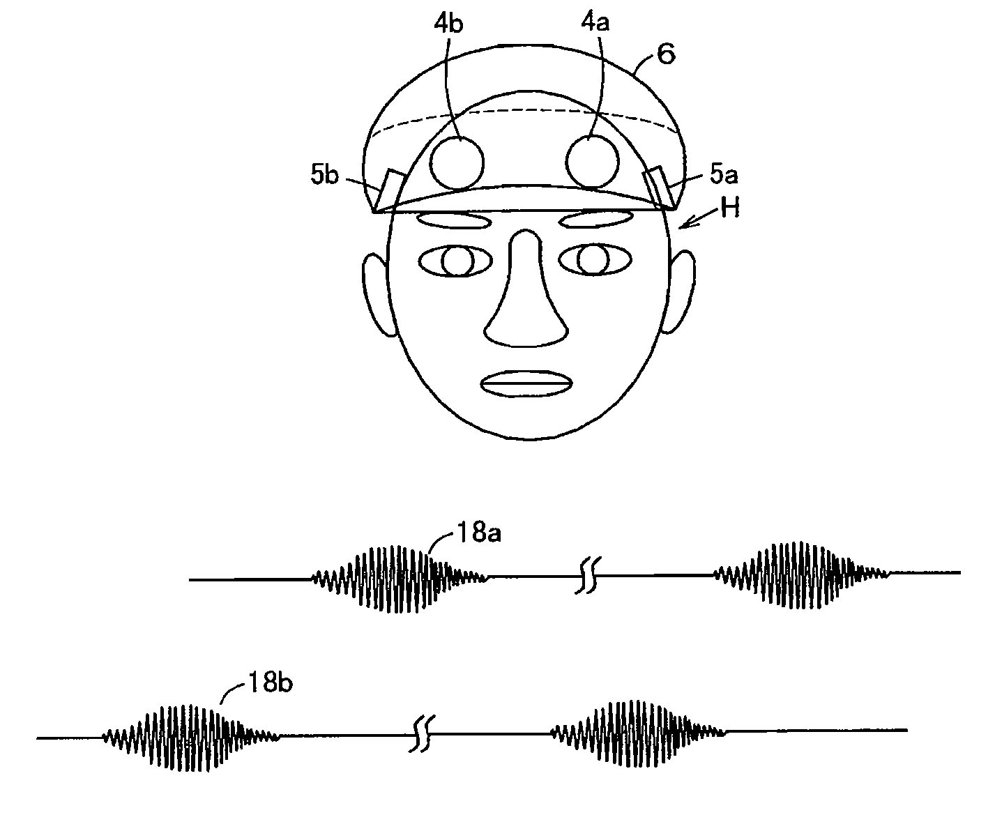 Neurological disease prevention apparatus through sound wave vibration