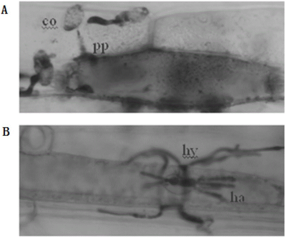 NAC transcription factor gene TaNACs in wheat as well as expression vector and application thereof