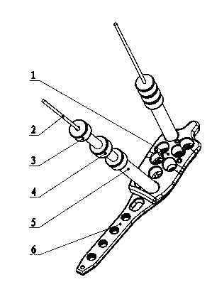 Lockplate surgical instrument