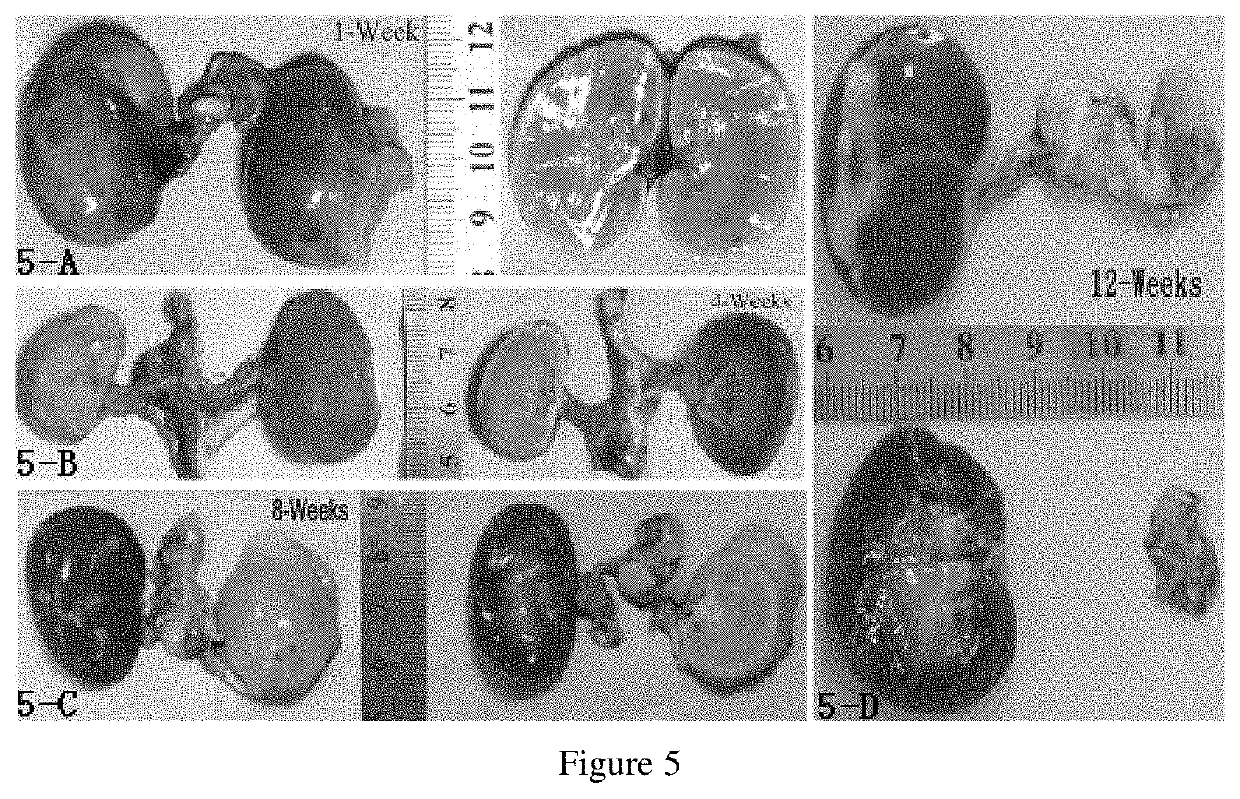 Embolism material for blood vessel, preparation method therefor and use thereof in preparation of drugs