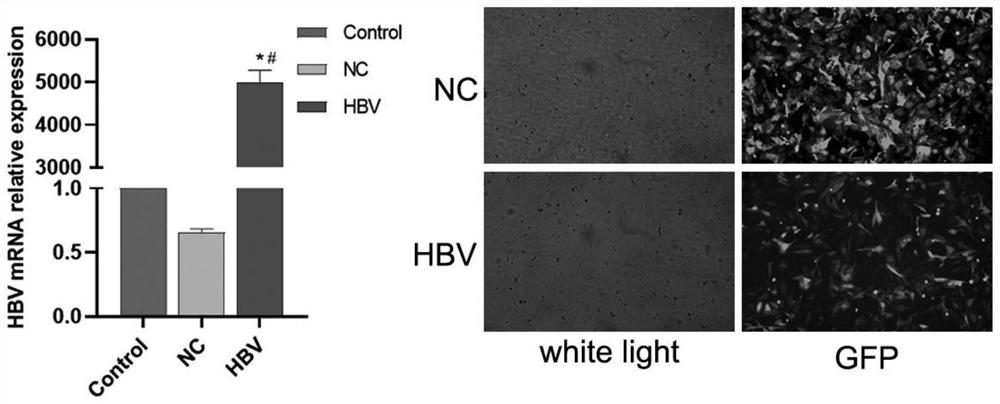 Method for researching CXCR3-mediated TLRs/MyD88 signal path in promoting hepatitis B cirrhosis canceration