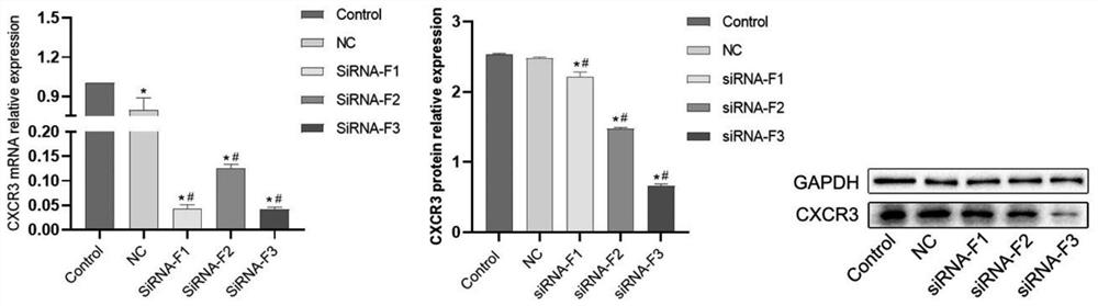 Method for researching CXCR3-mediated TLRs/MyD88 signal path in promoting hepatitis B cirrhosis canceration