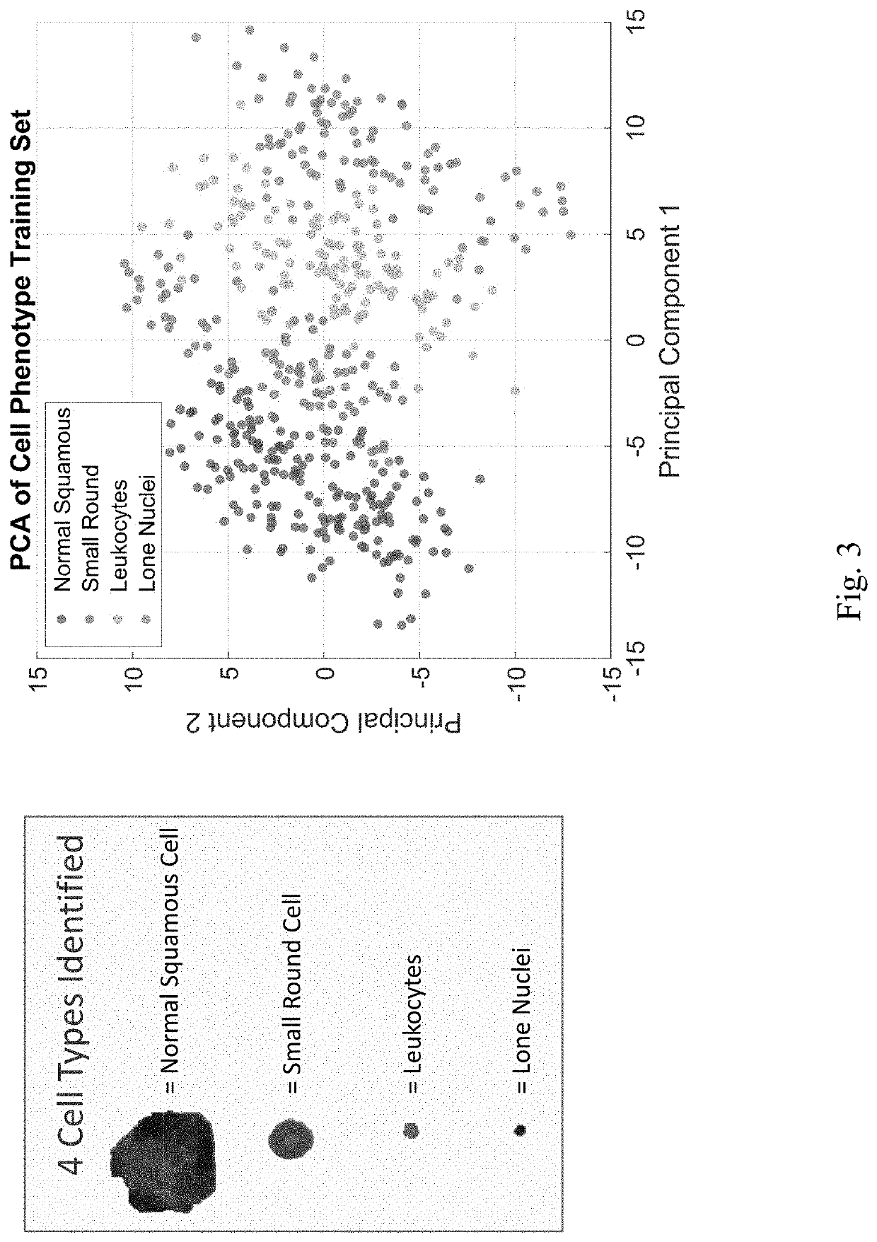 Systems and Methods of Oral Cancer Assessment Using Cellular Phenotype Data