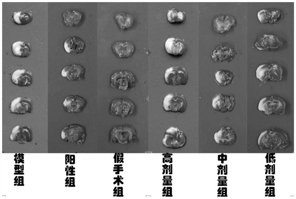 Application of trigonin a in the preparation of anti-ischemic stroke medicine