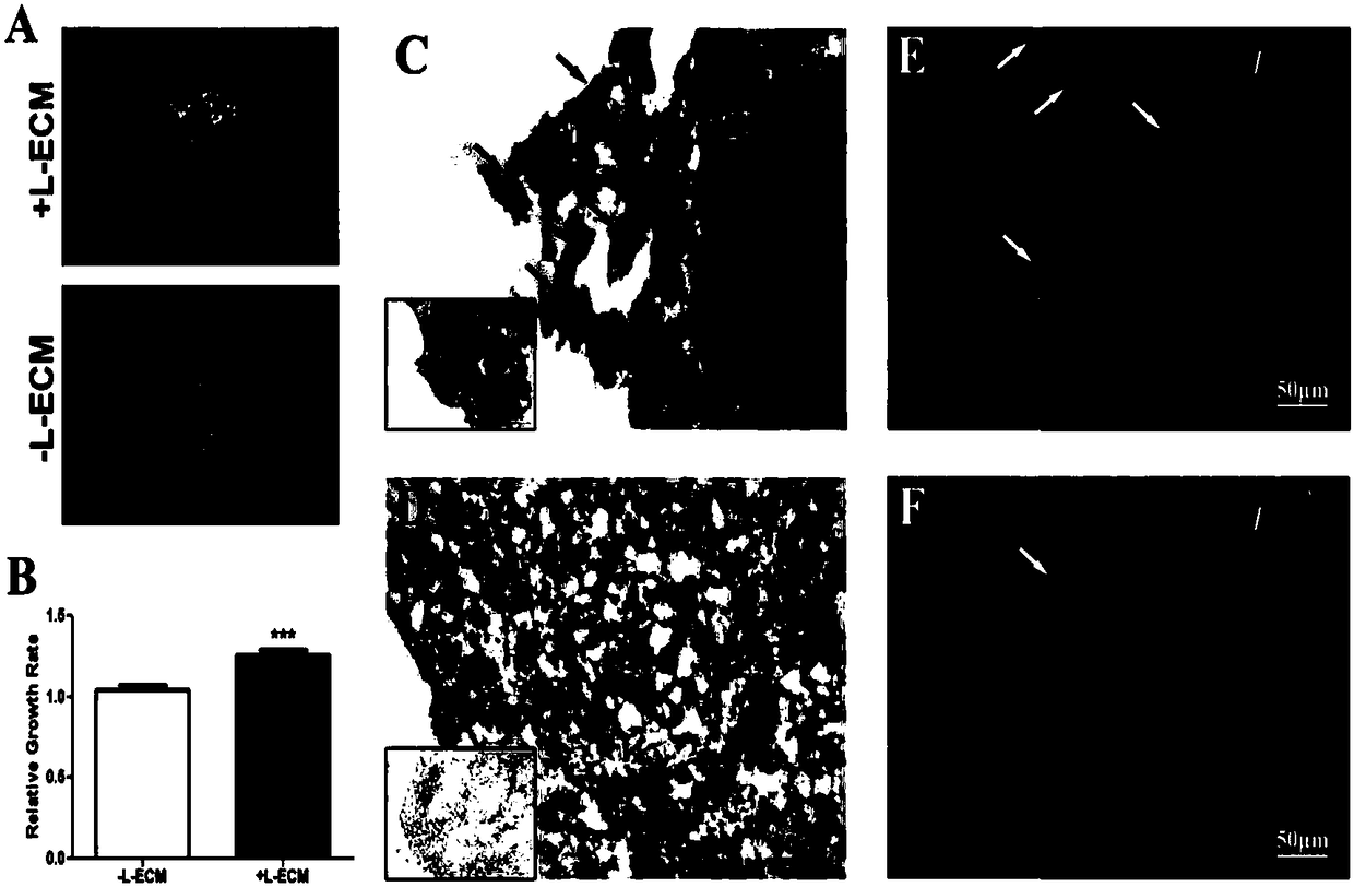 Preparation method of extracellular matrix for promoting differentiation of bone marrow stem cells into liver cells