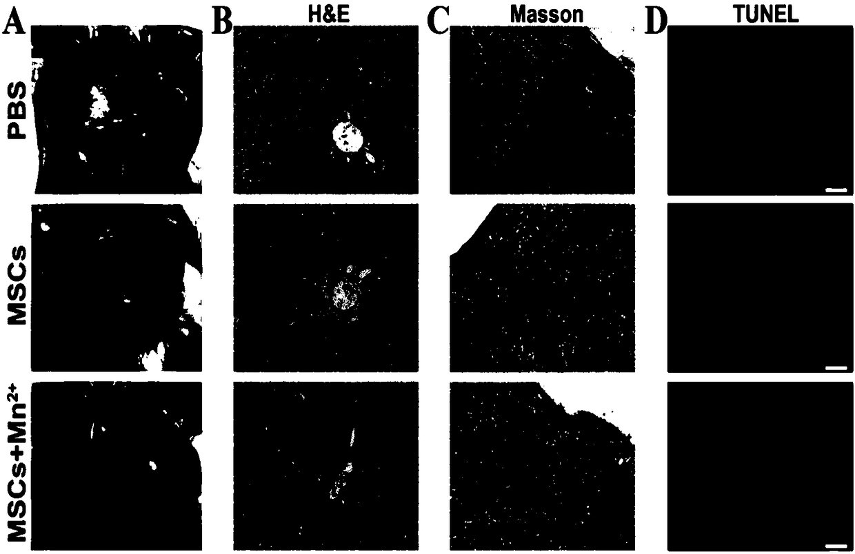 Preparation method of extracellular matrix for promoting differentiation of bone marrow stem cells into liver cells