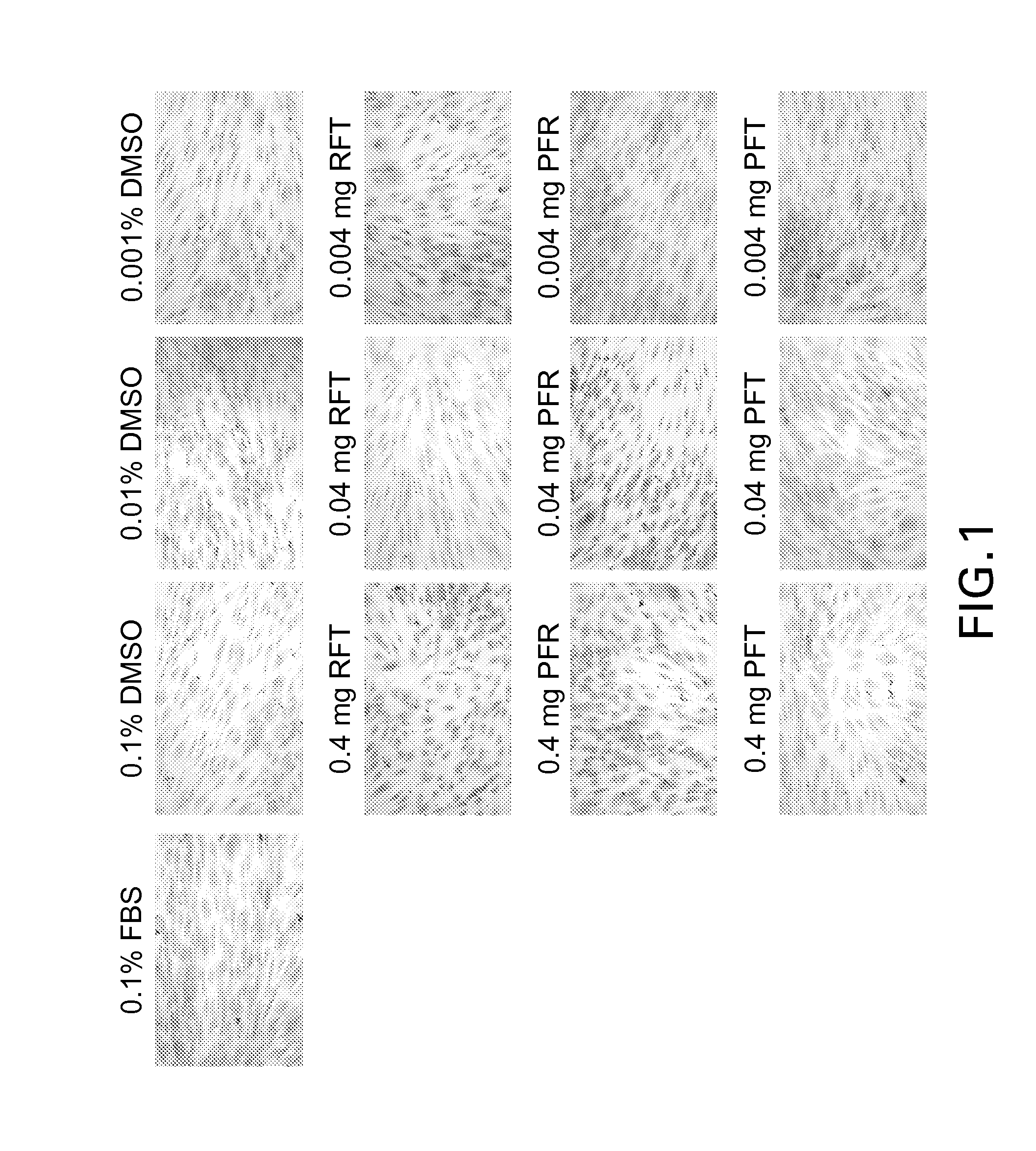 Antioxidant compositions for soft oral tissue and methods of formulation and use thereof