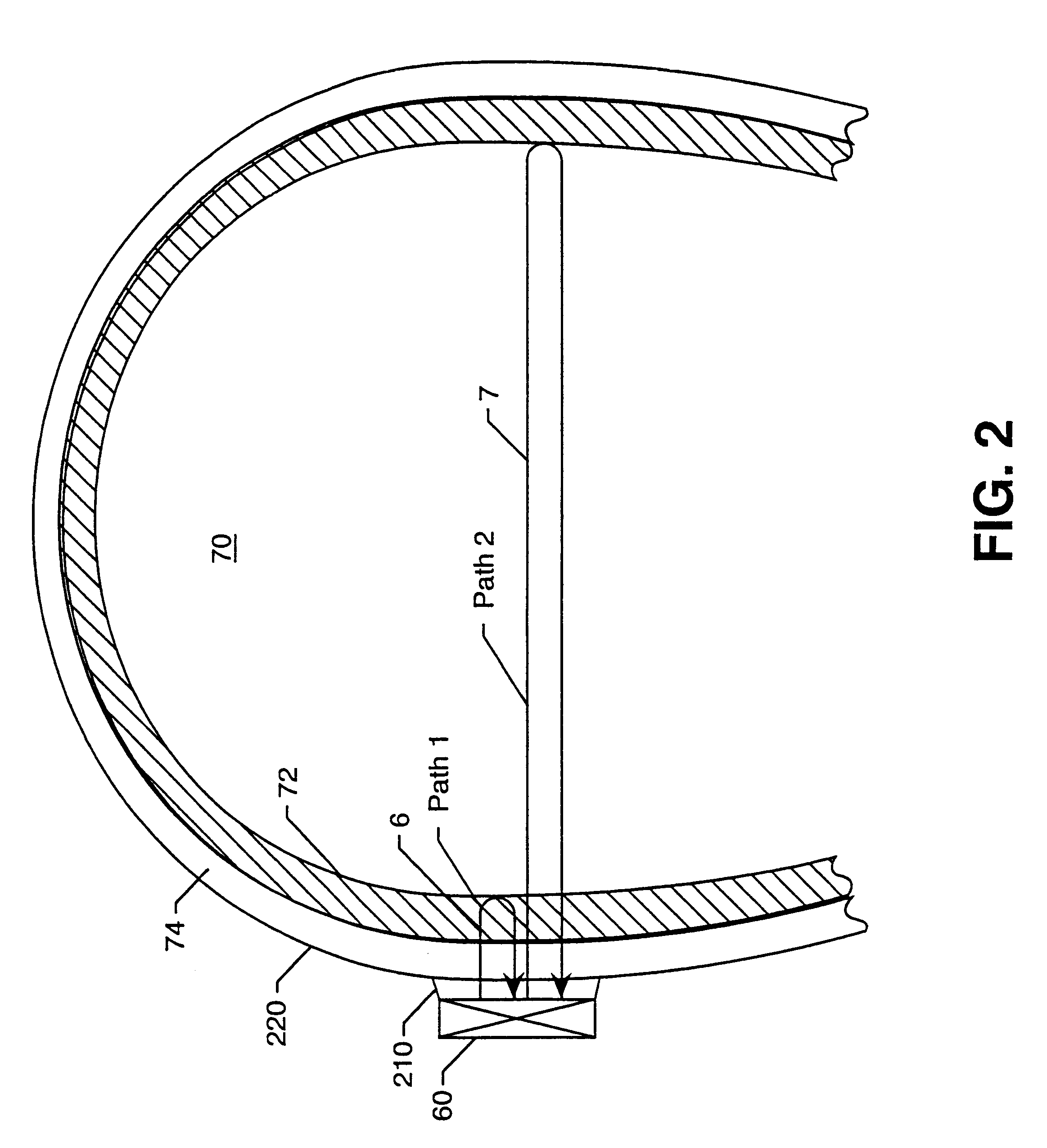 Method and apparatus for assessment of changes in intracranial pressure