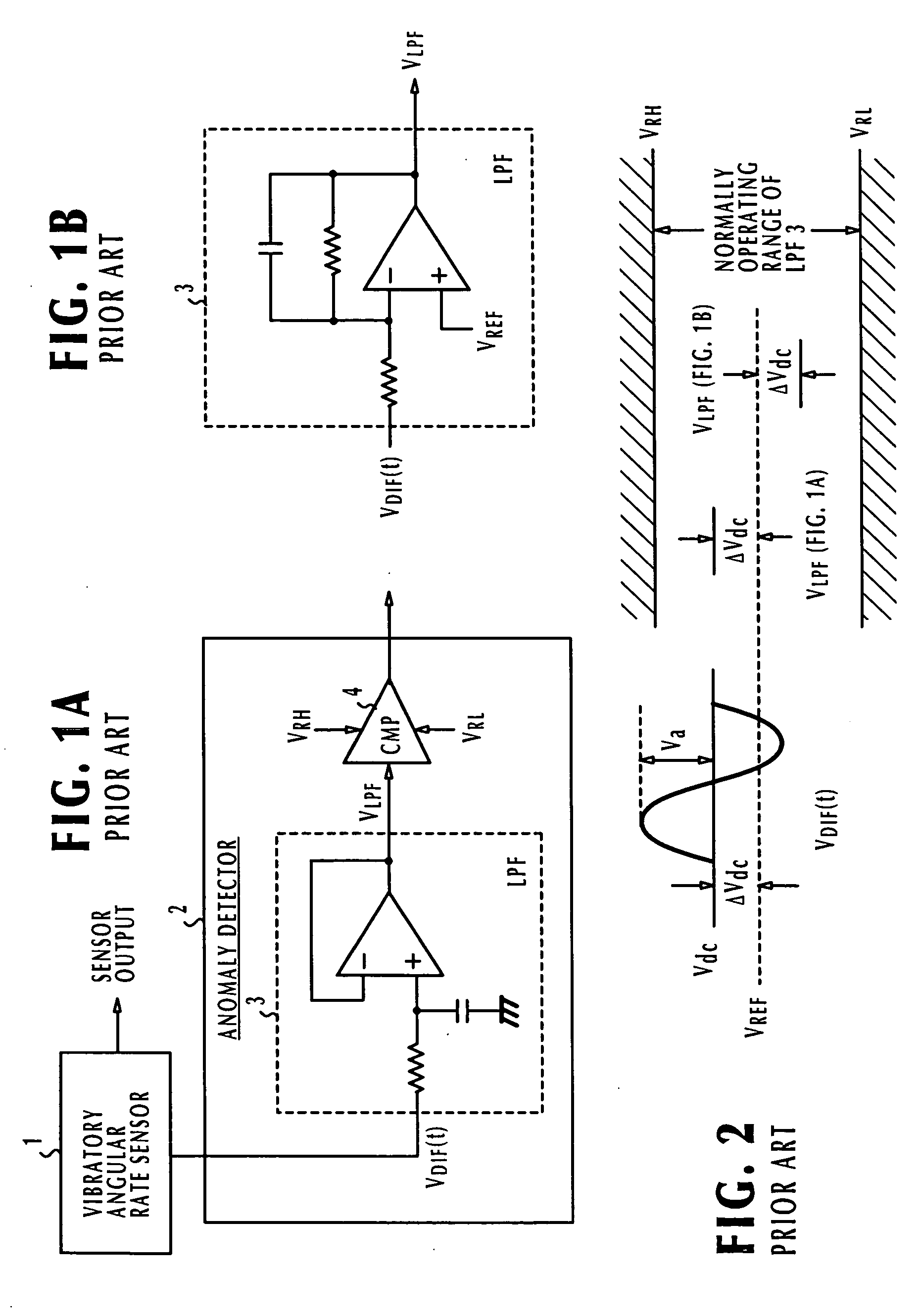 Anomaly detector for vibratory angular rate sensor