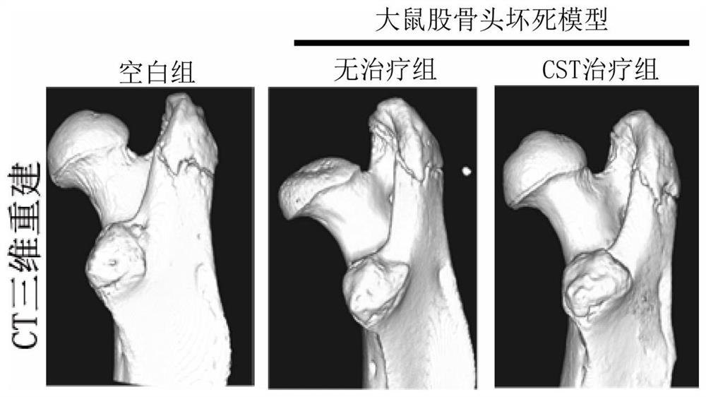 Application of CST polypeptide in preparation of medicine for treating femoral head necrosis
