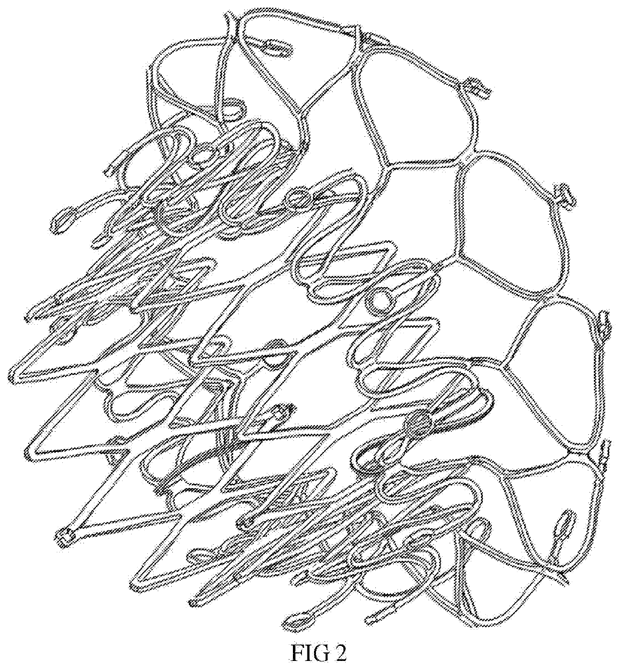 Low profile heart valve and delivery system