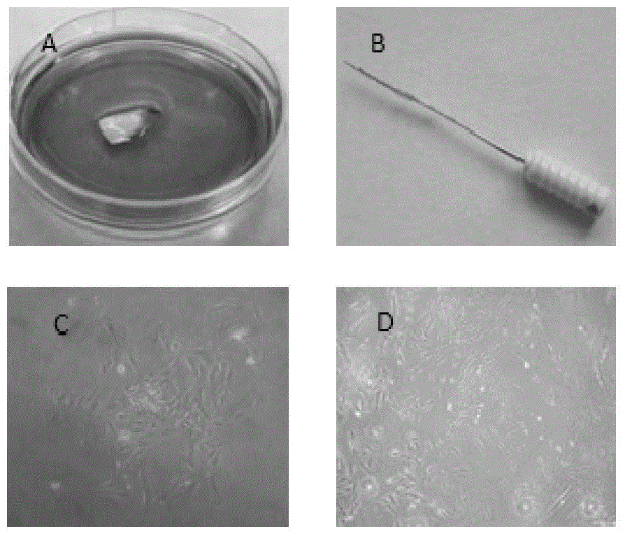 Method for immortalizing human exfoliated deciduous tooth endodontium stem cell line through hTERT recombinant lentivirus