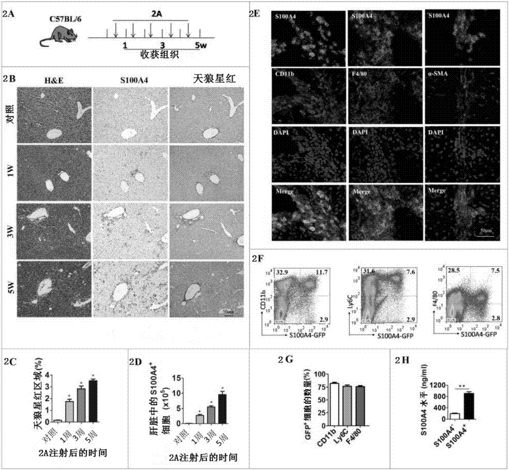 Application of anti-S100A4 antibody in injury of anti-CD137 antibody-mediated antitumor immunity