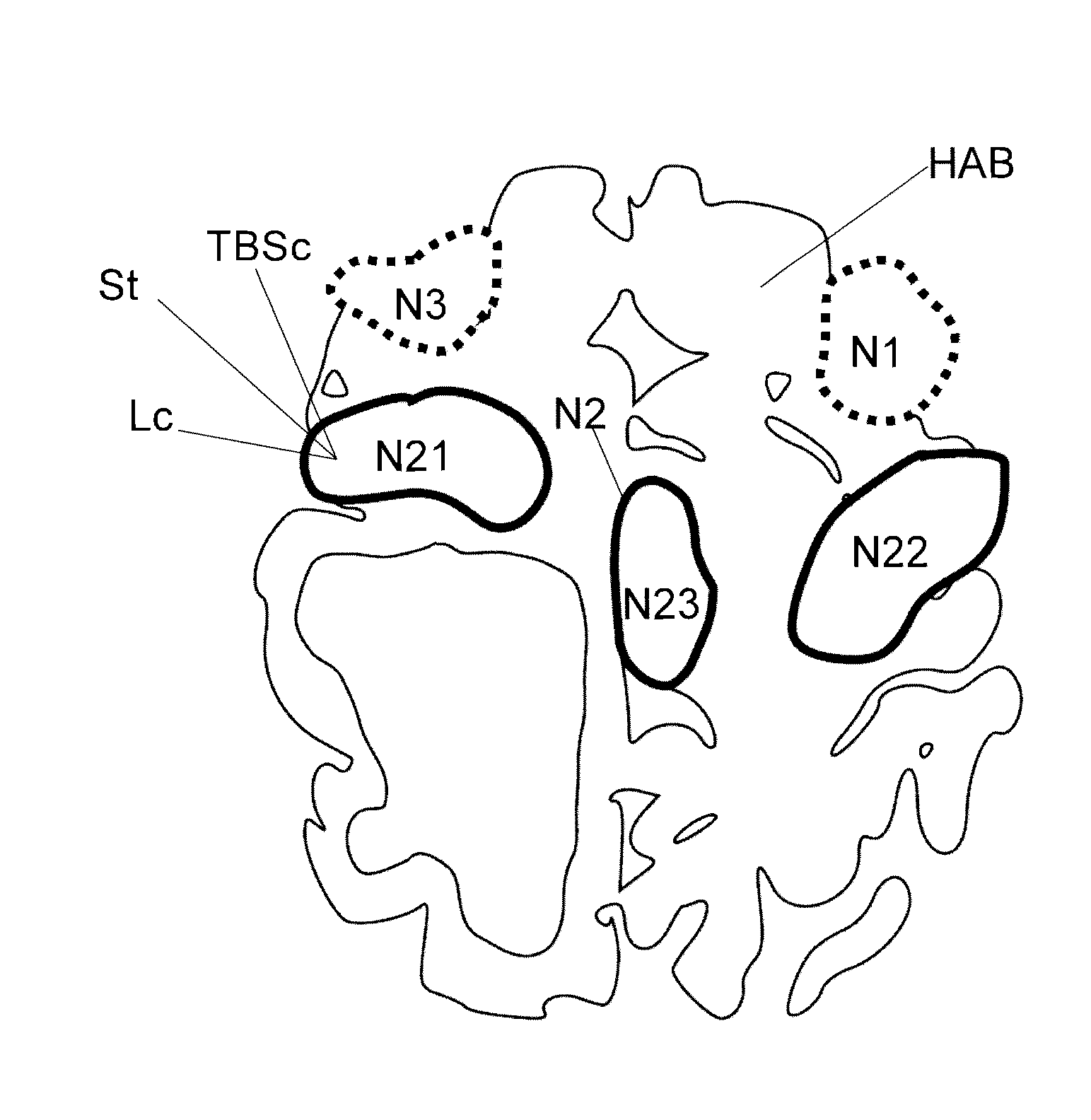 Method and device for determining target brain segments in human or animal brains