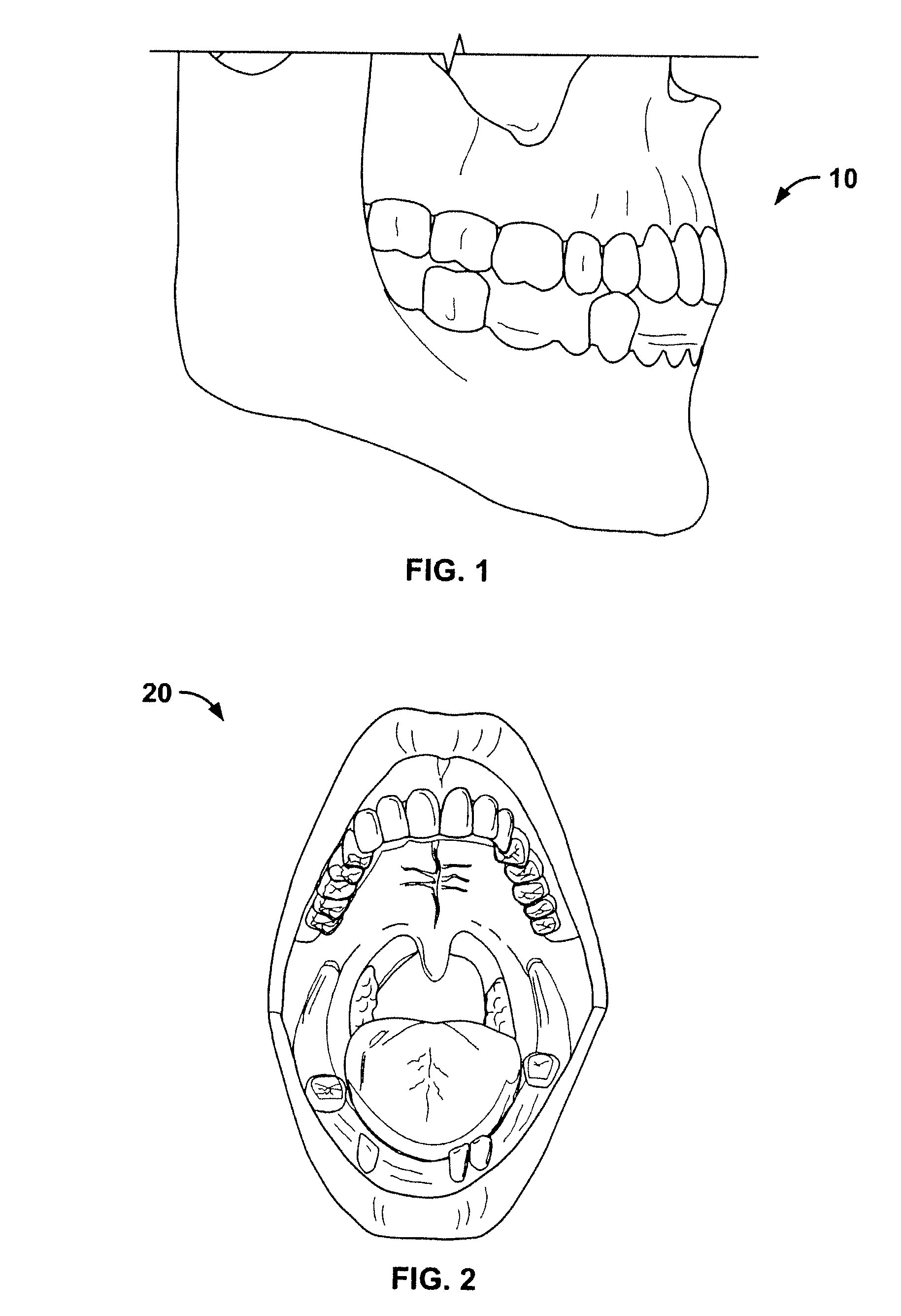 Method for pre-operative visualization of instrumentation used with a surgical guide for dental implant placement