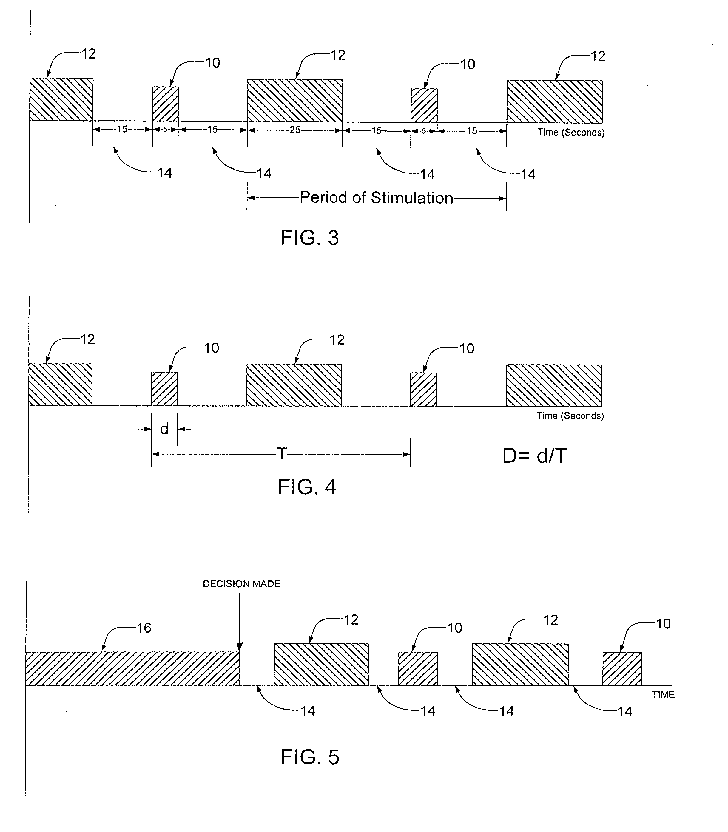 Systems and methods of reducing artifact in neurological stimulation systems