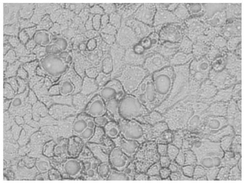 Caco-2 cell monolayer membrane forming culture method