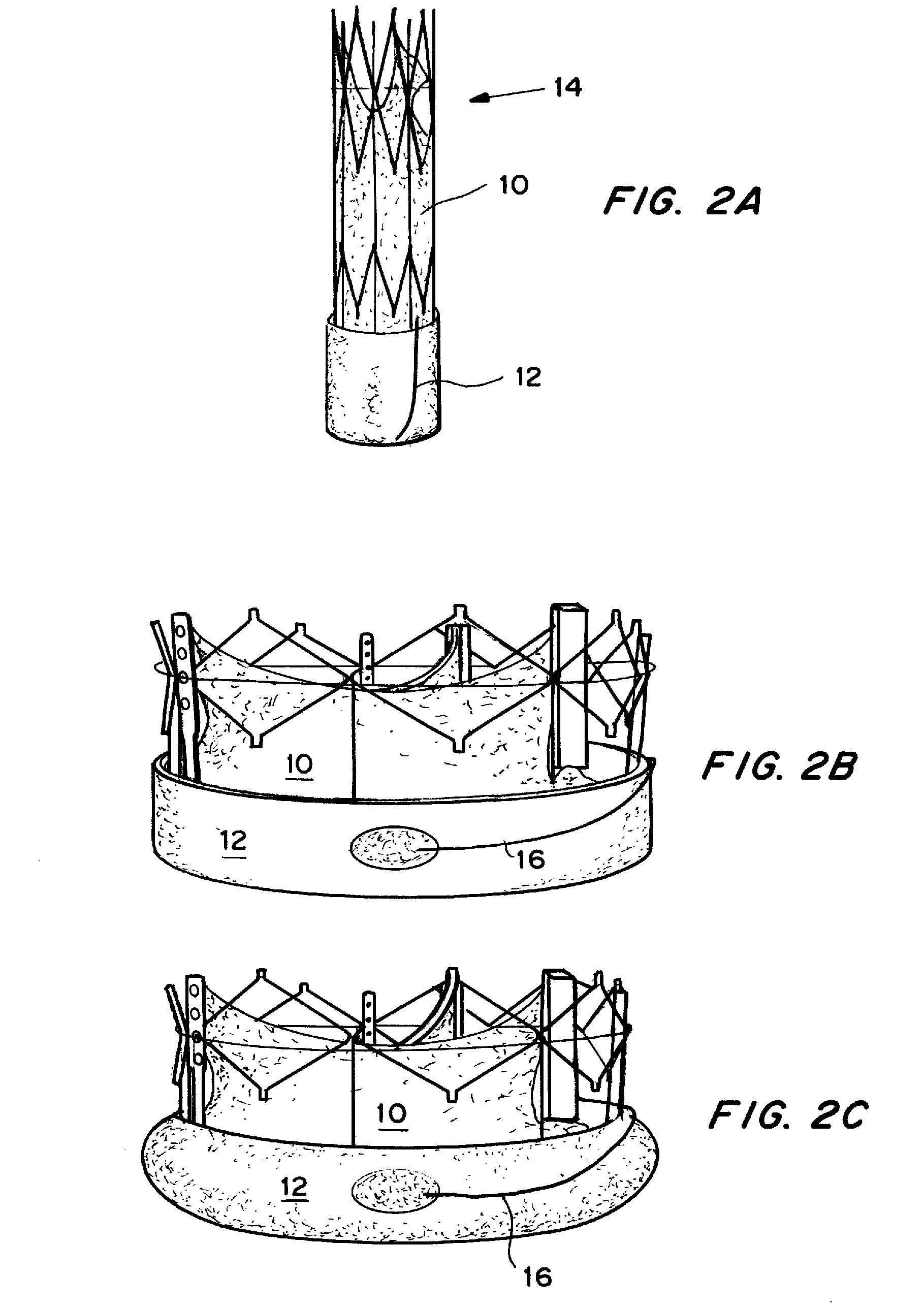 Means for Controlled Sealing of Endovascular Devices