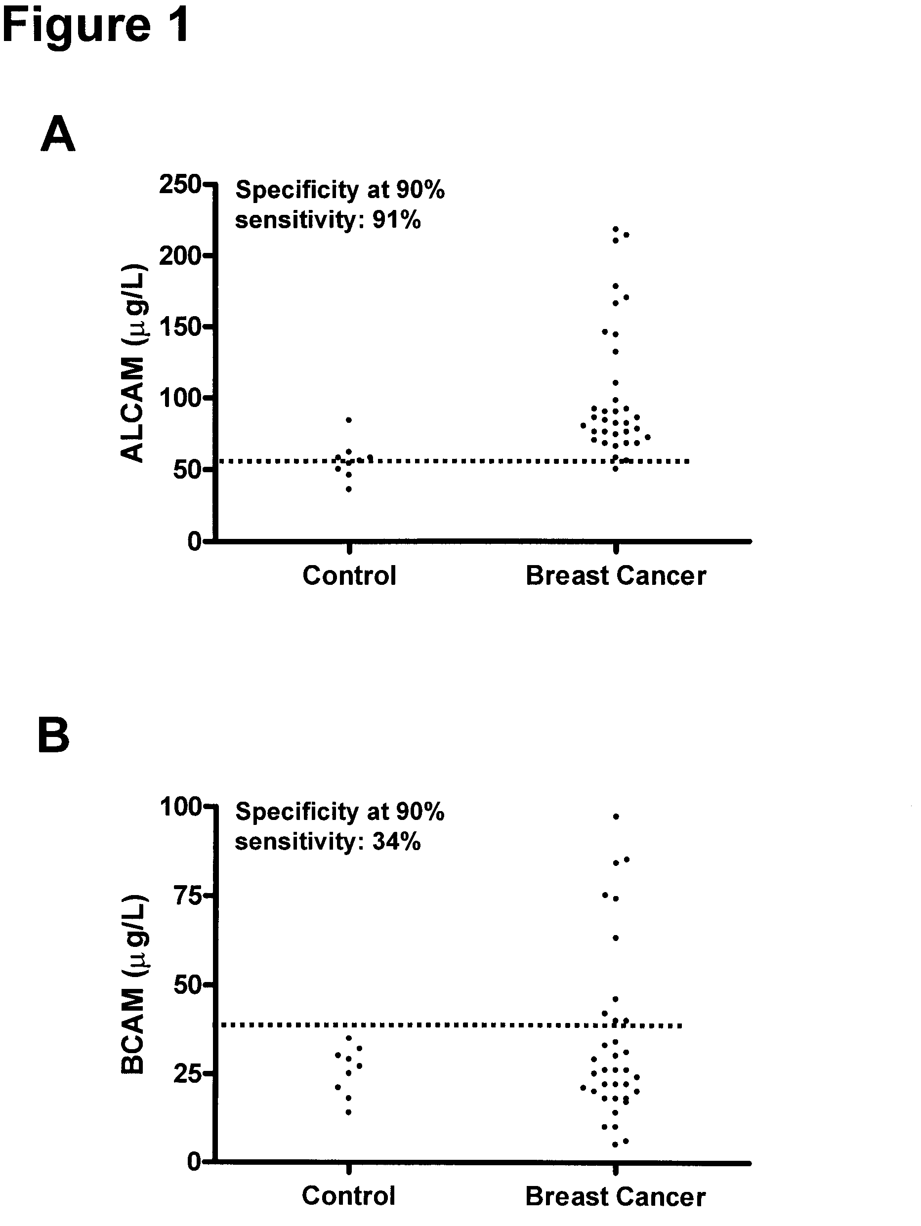 Method for the detection of breast cancer by determining alcam and/or bcam levels in a patient