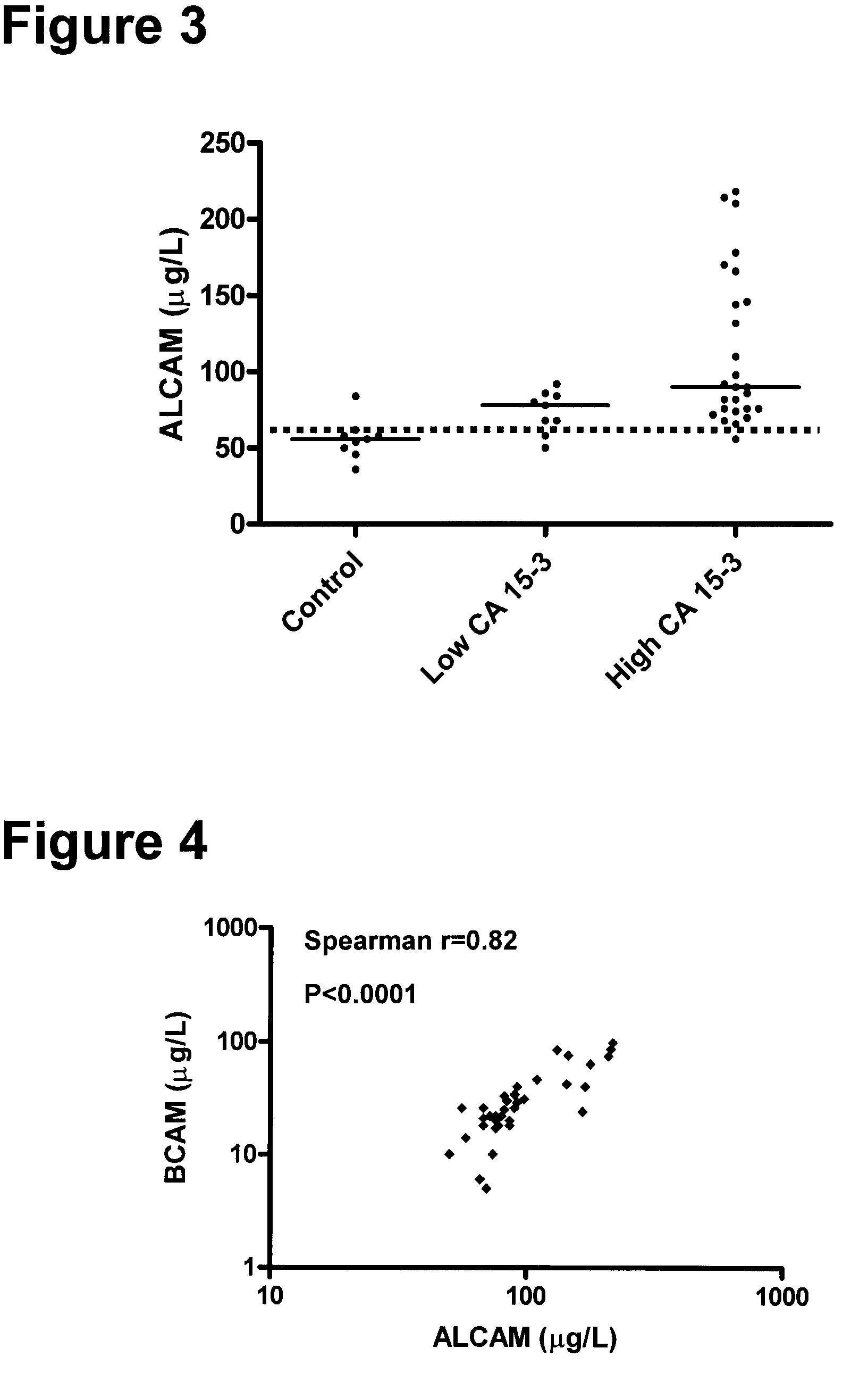 Method for the detection of breast cancer by determining alcam and/or bcam levels in a patient