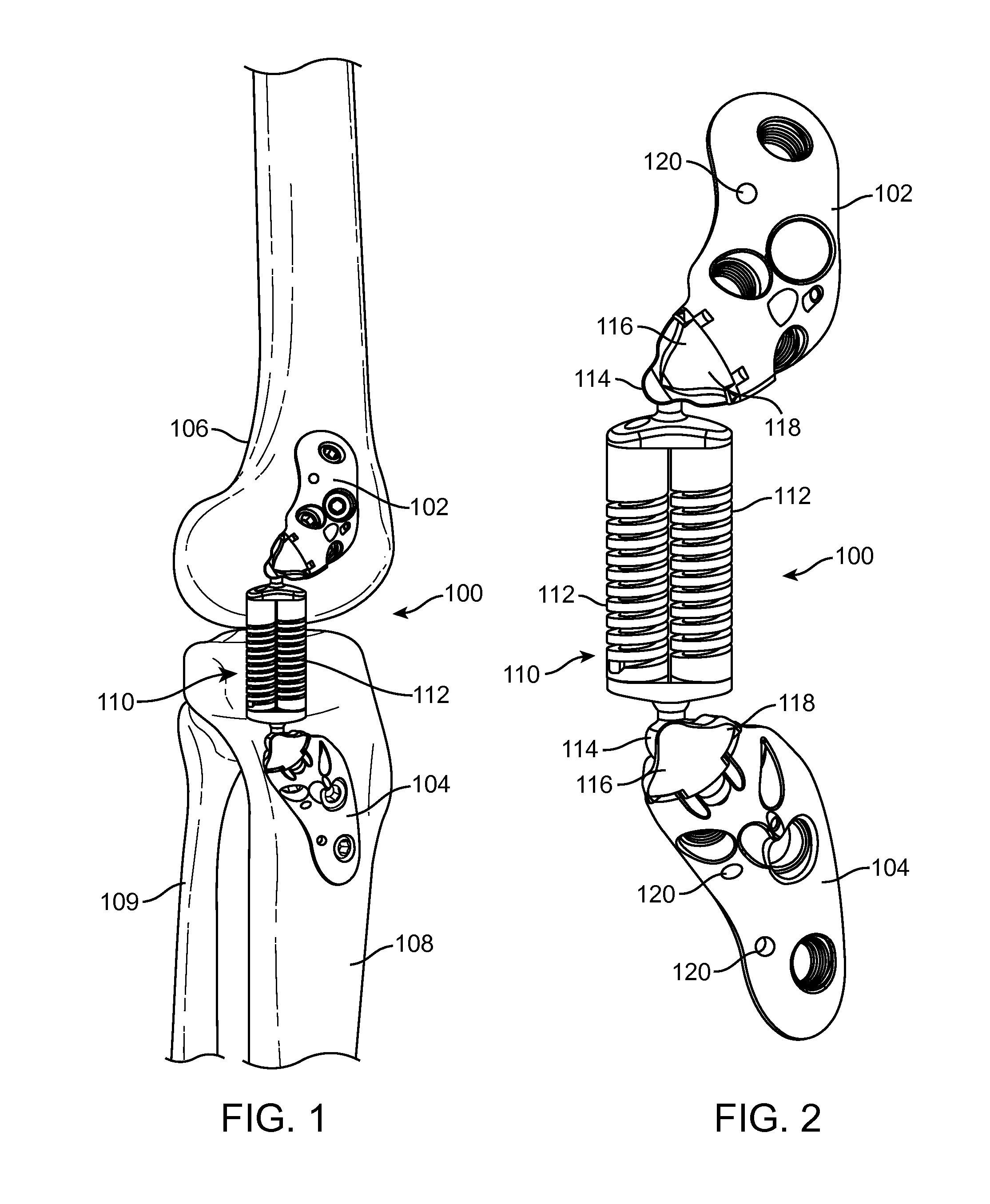 Methods and devices for joint load control during healing of joint tissue