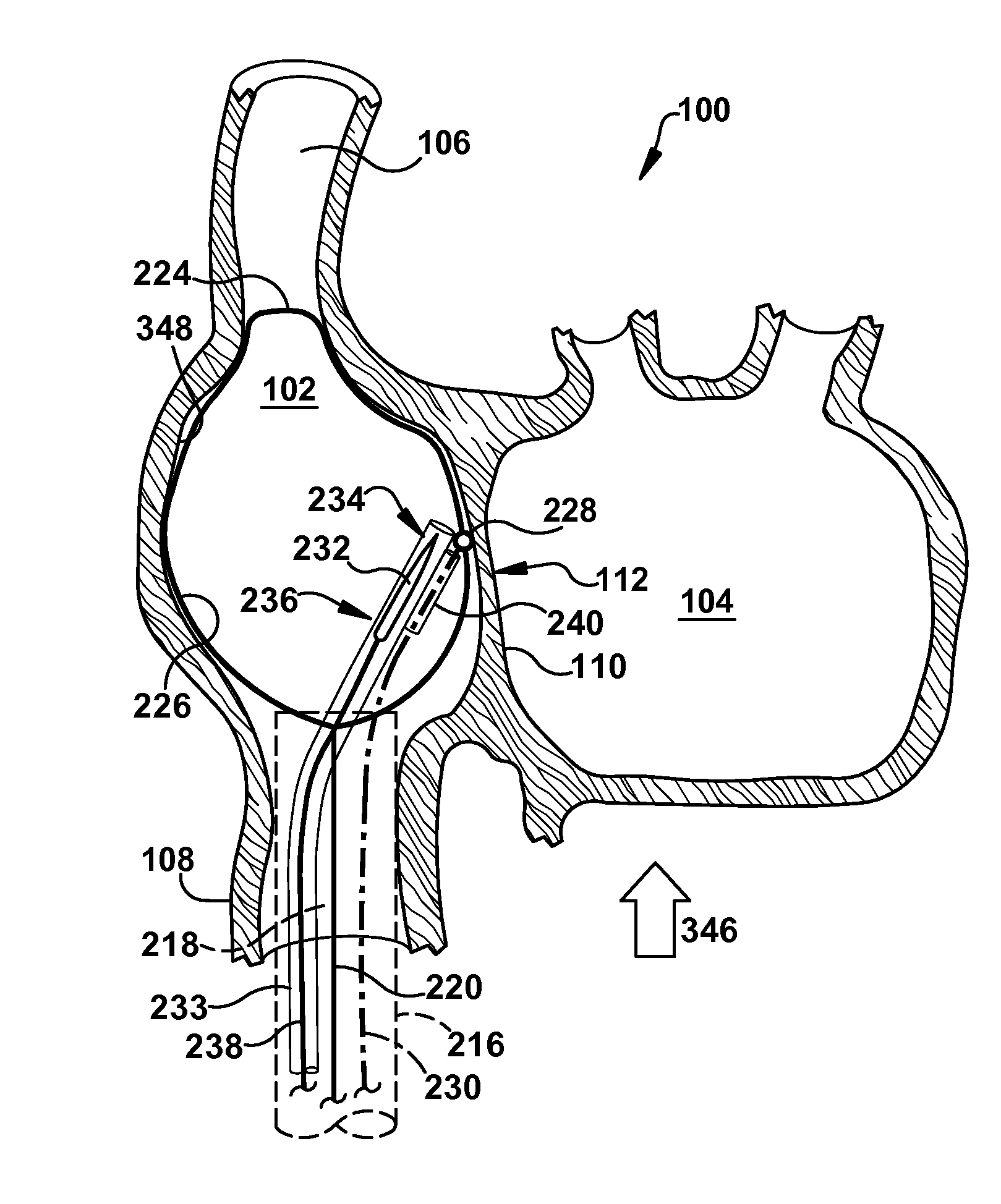 Apparatus and method for targeting a body tissue