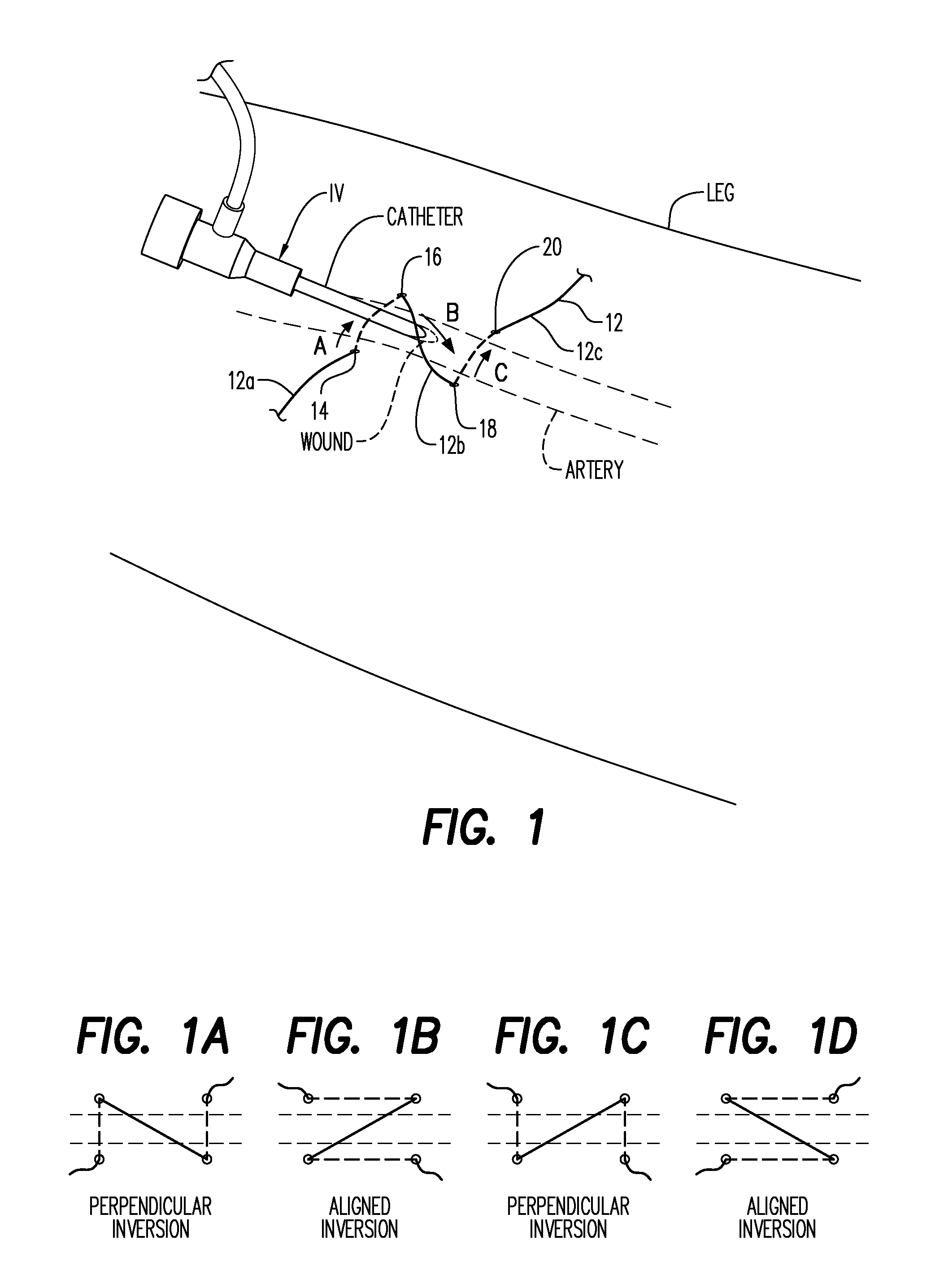 Vascular Access Wound Sealing System and Method