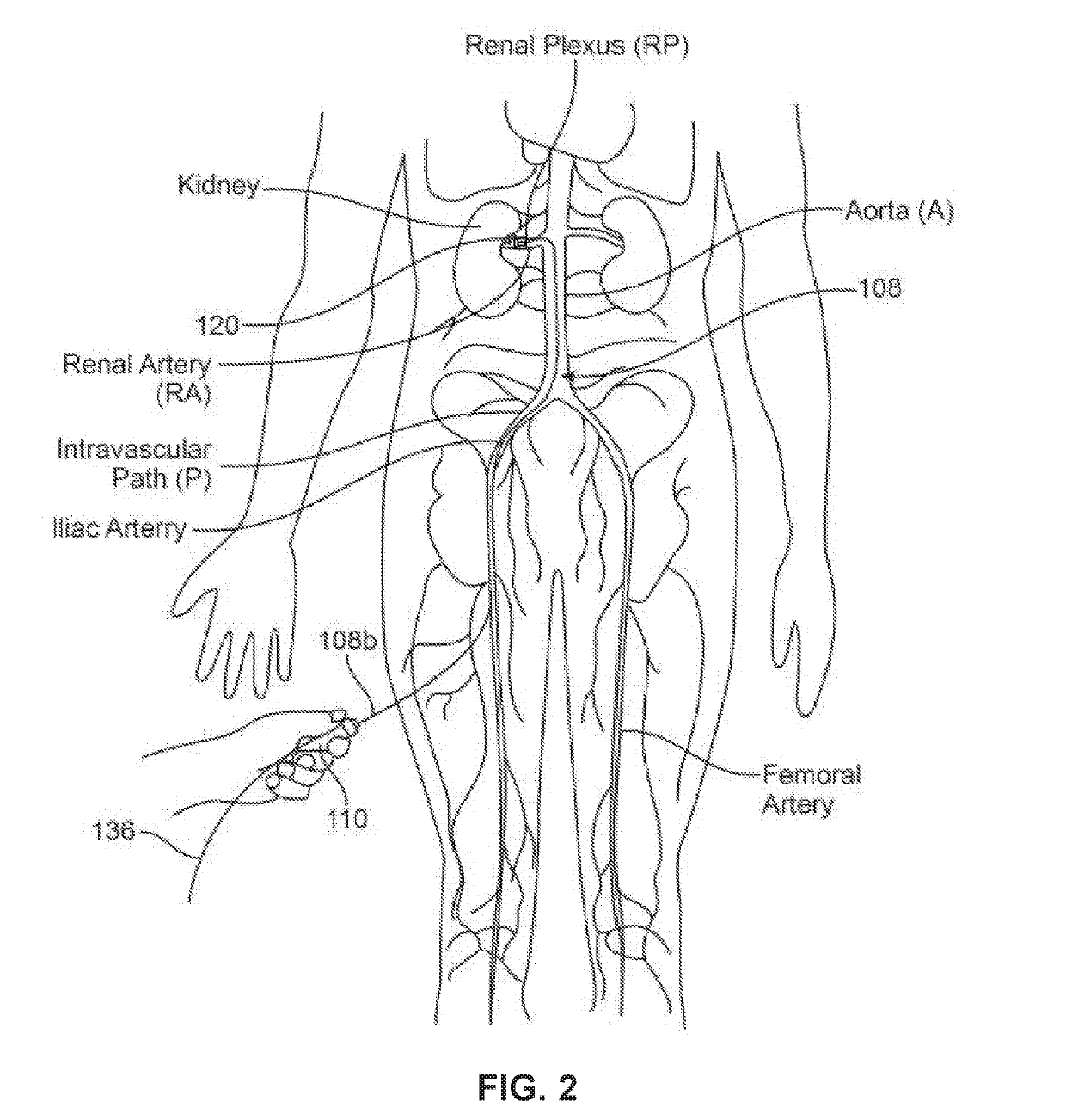 Systems, devices, and associated methods for neuromodulation in heterogeneous tissue environments