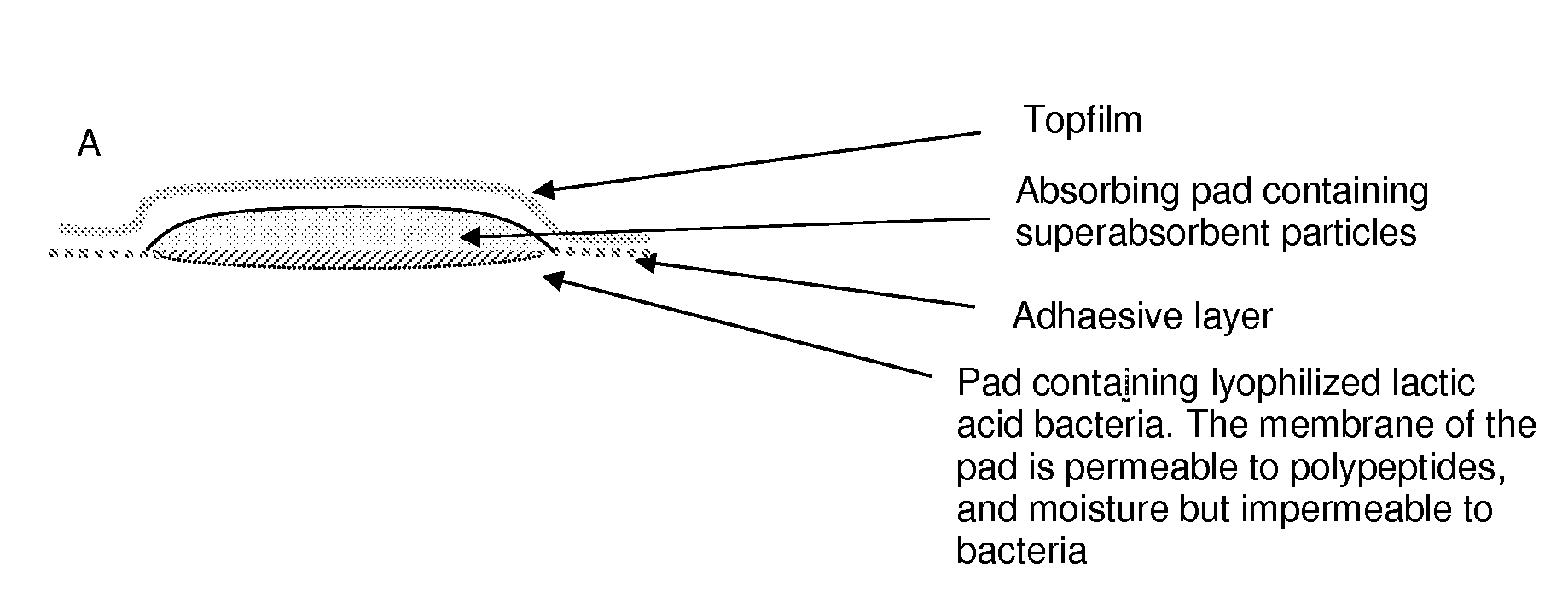 Wound or tissue dressing comprising lactic acid bacteria
