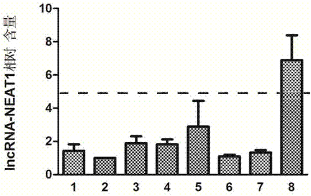 Kit for detecting IncRNA-NEAT1 in serum and application thereof in liver cancer serological diagnosis